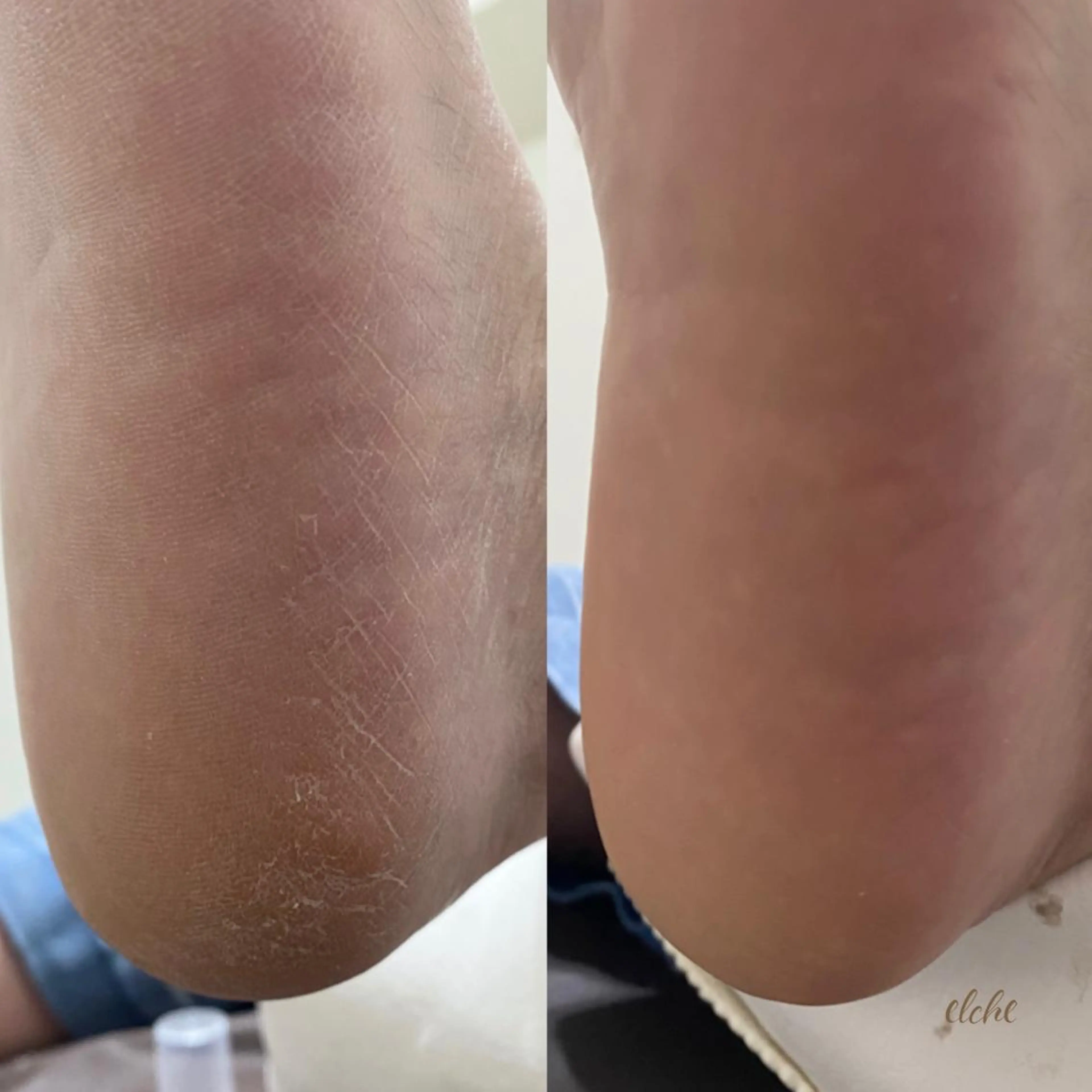 ネイル Rio 𓍼のネイルデザイン