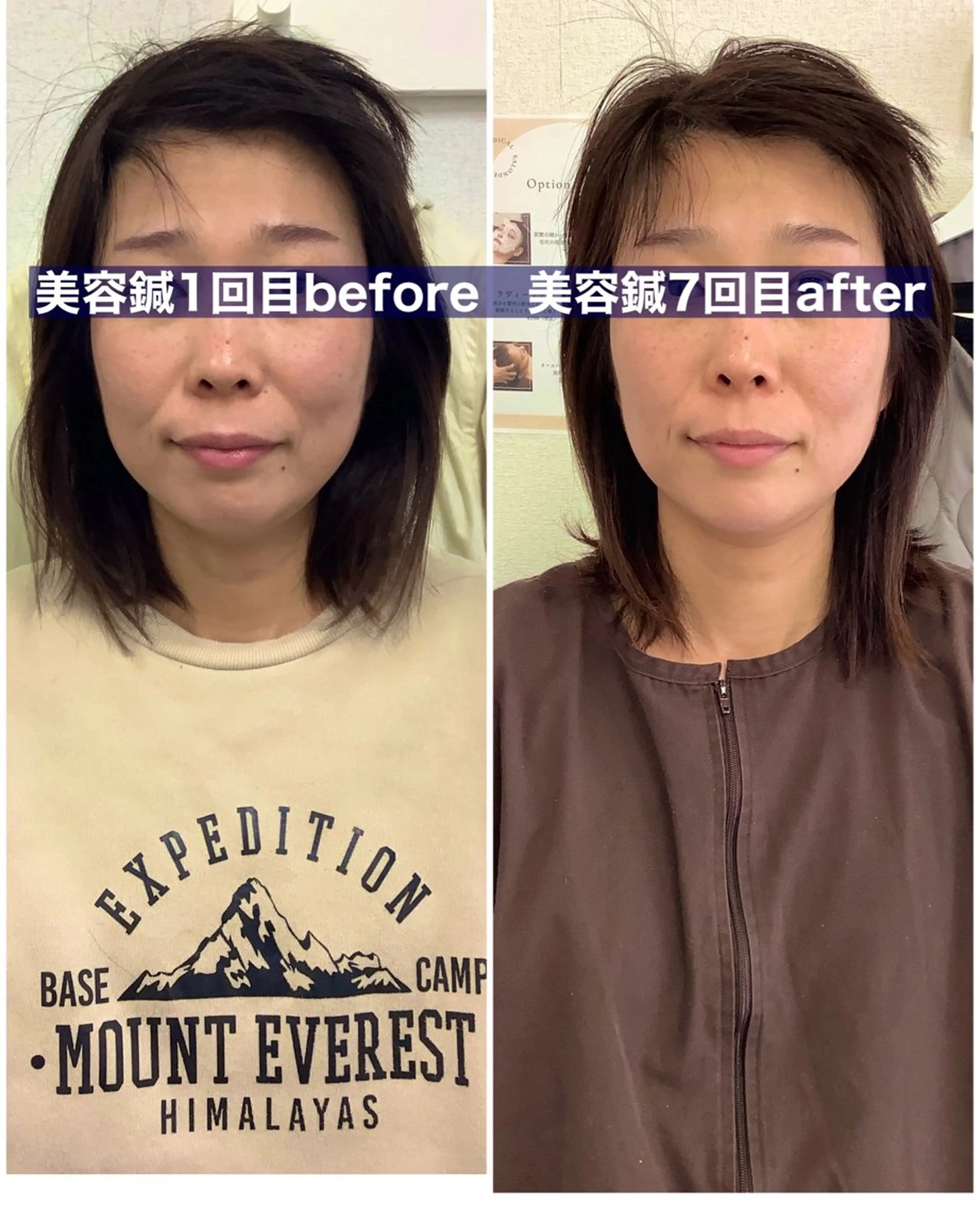 エステ リラク メディカルサロンドオフ所属・ハリサロンドオフ 美容鍼灸×小顔整体のエステ・リラクイメージ