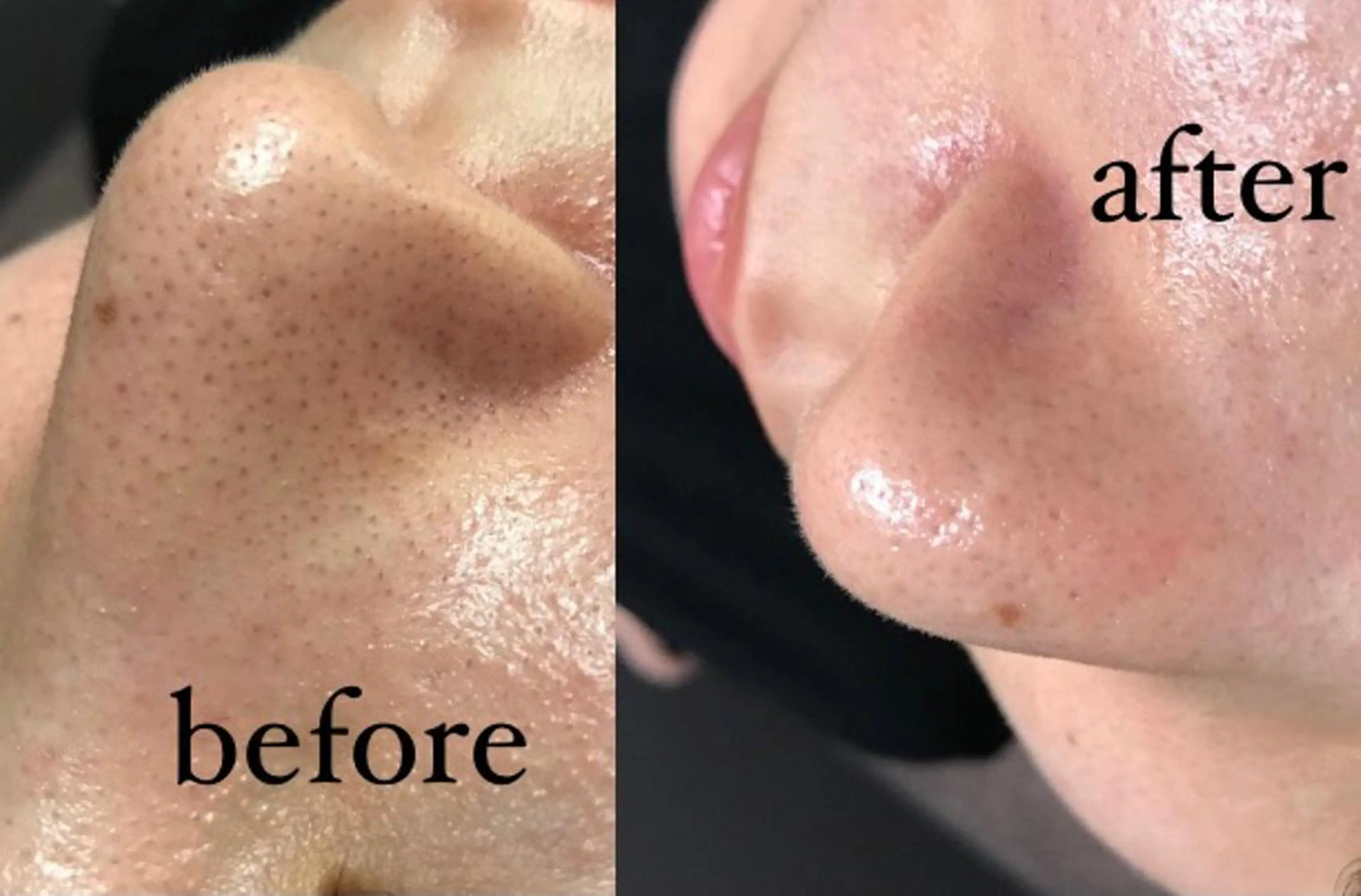 Lilyboo 多田のエステ・リラクイメージ