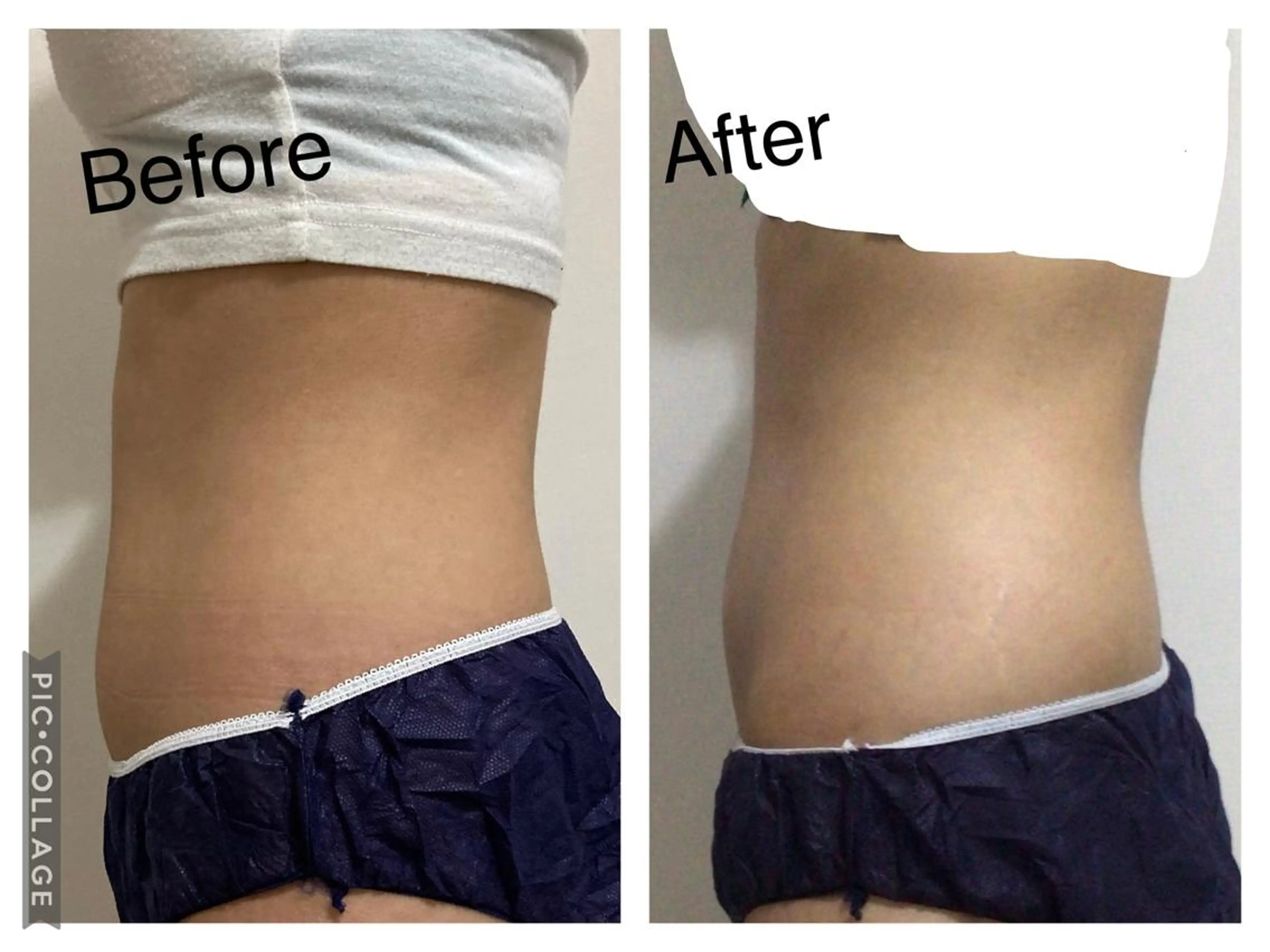 子宮矯正/腸揉み/ シュガーリング脱毛のエステ・リラクイメージ