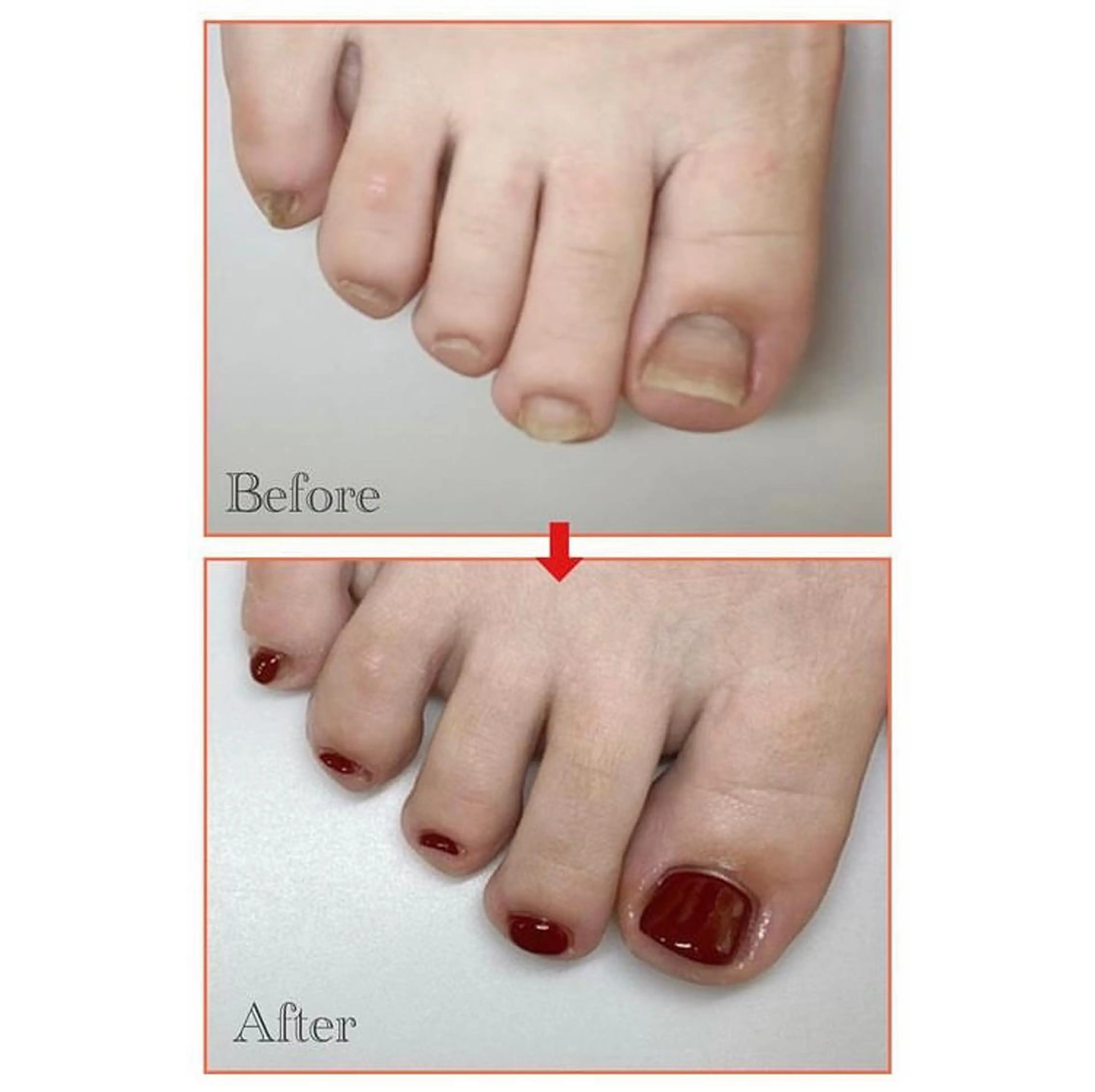 ネイル フットネイル ネイルサロン アリュームのネイルデザイン