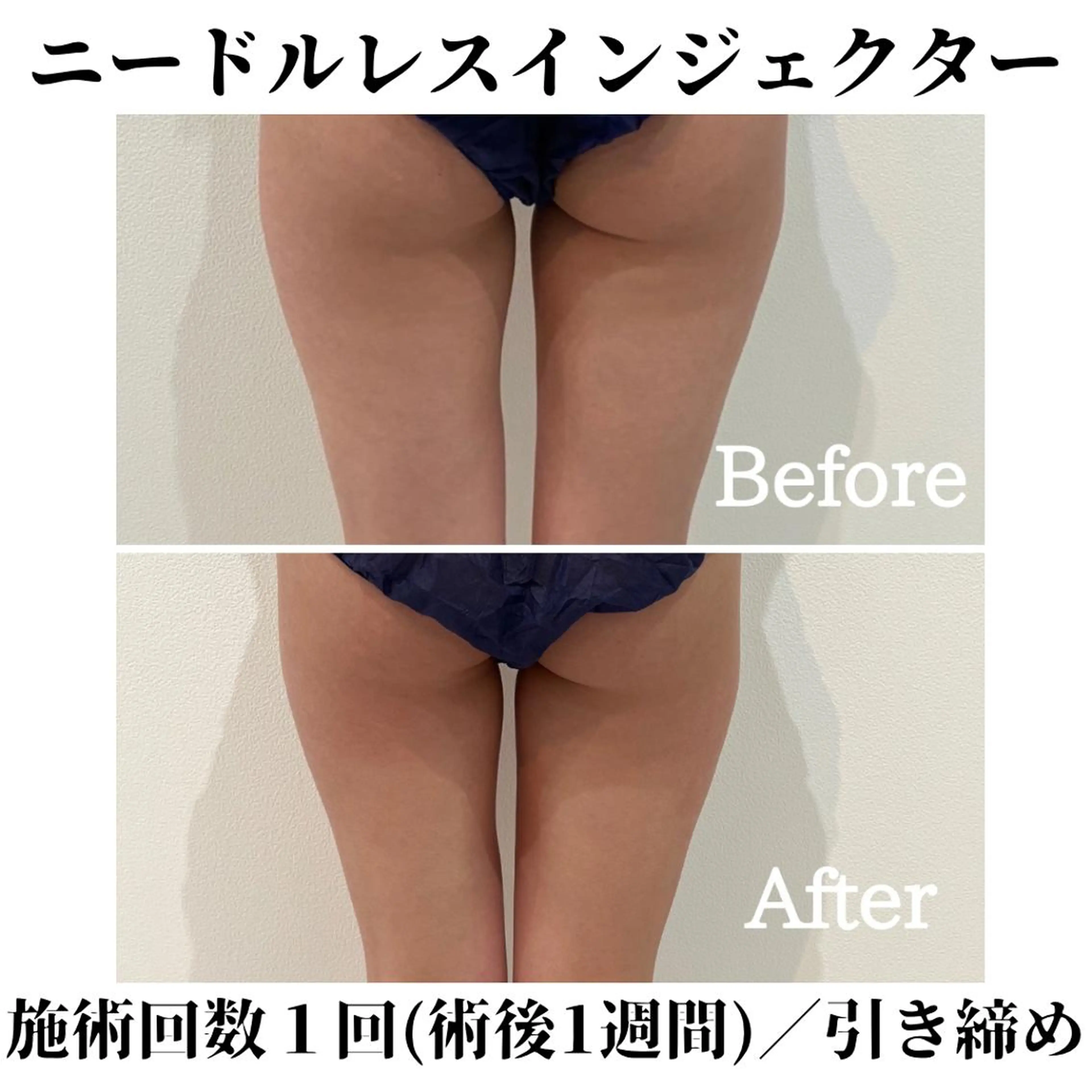 トータルビューティー サロンSalaのマツエク・マツパデザイン