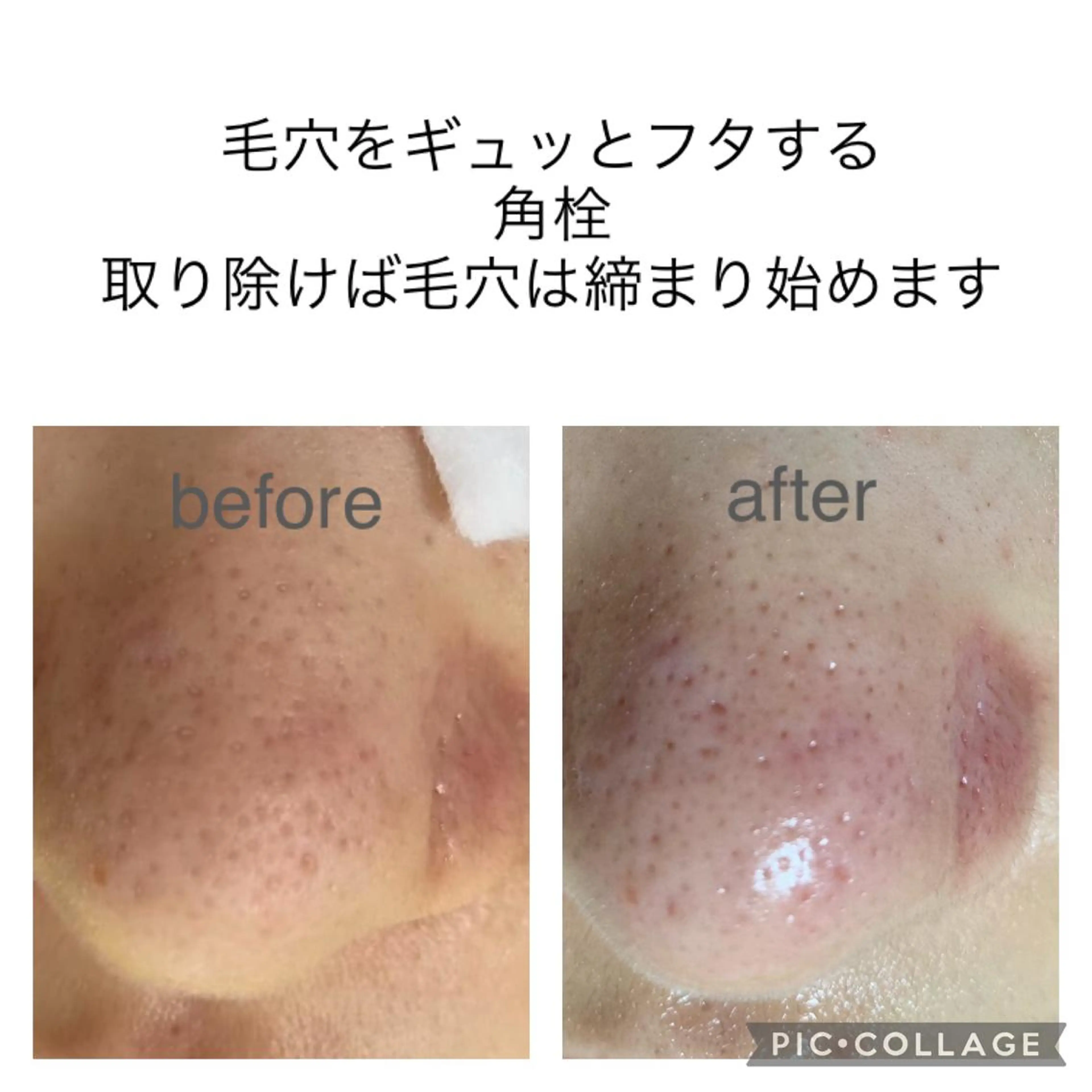 毛穴ケア・肌質改善 徳川のエステ・リラクイメージ