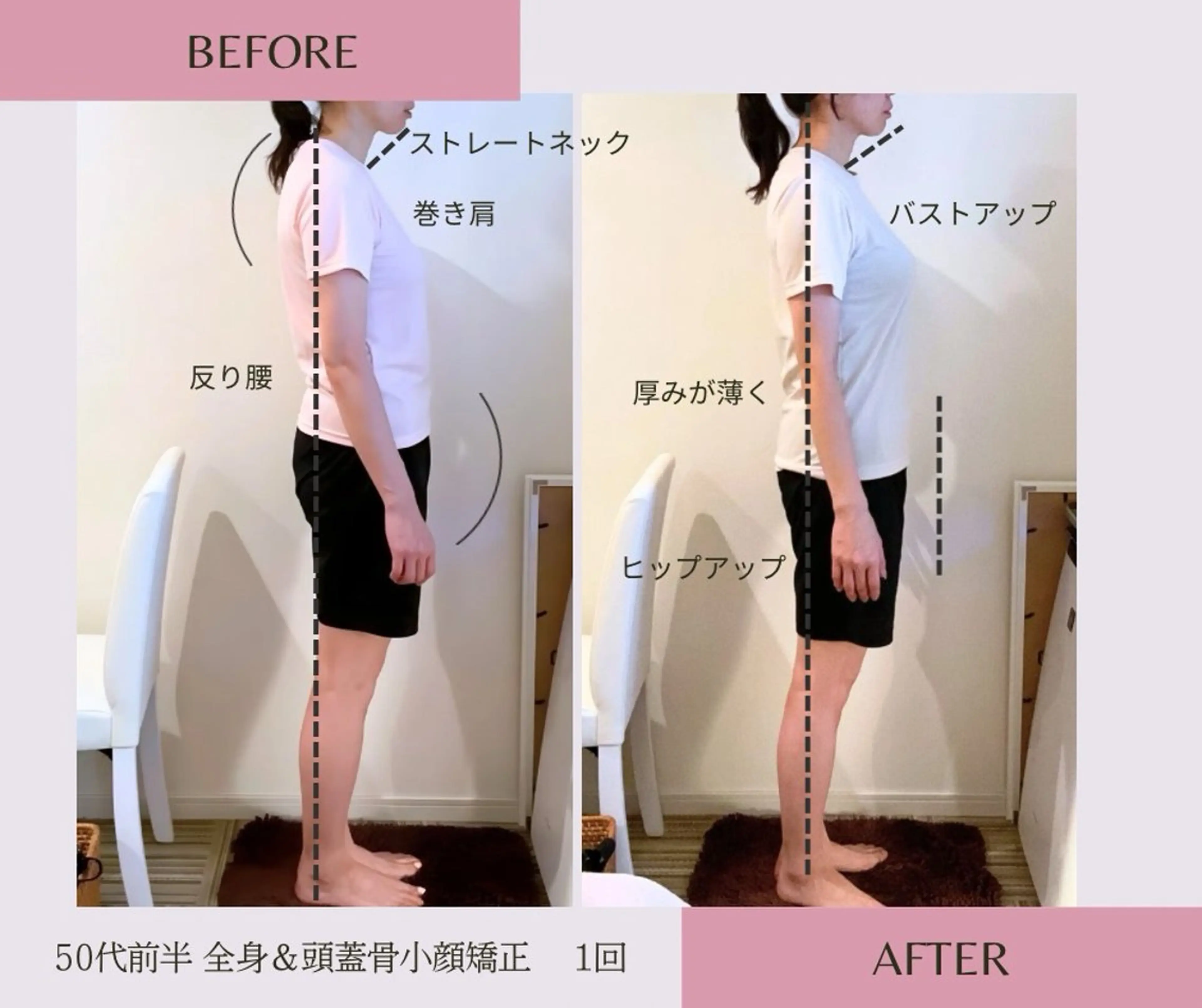 人気No,2【大反響✨速攻実感！見た目マイナス５キロ】全身＆頭蓋骨小顔×痩身マシン2種 120分　初回体験の写真