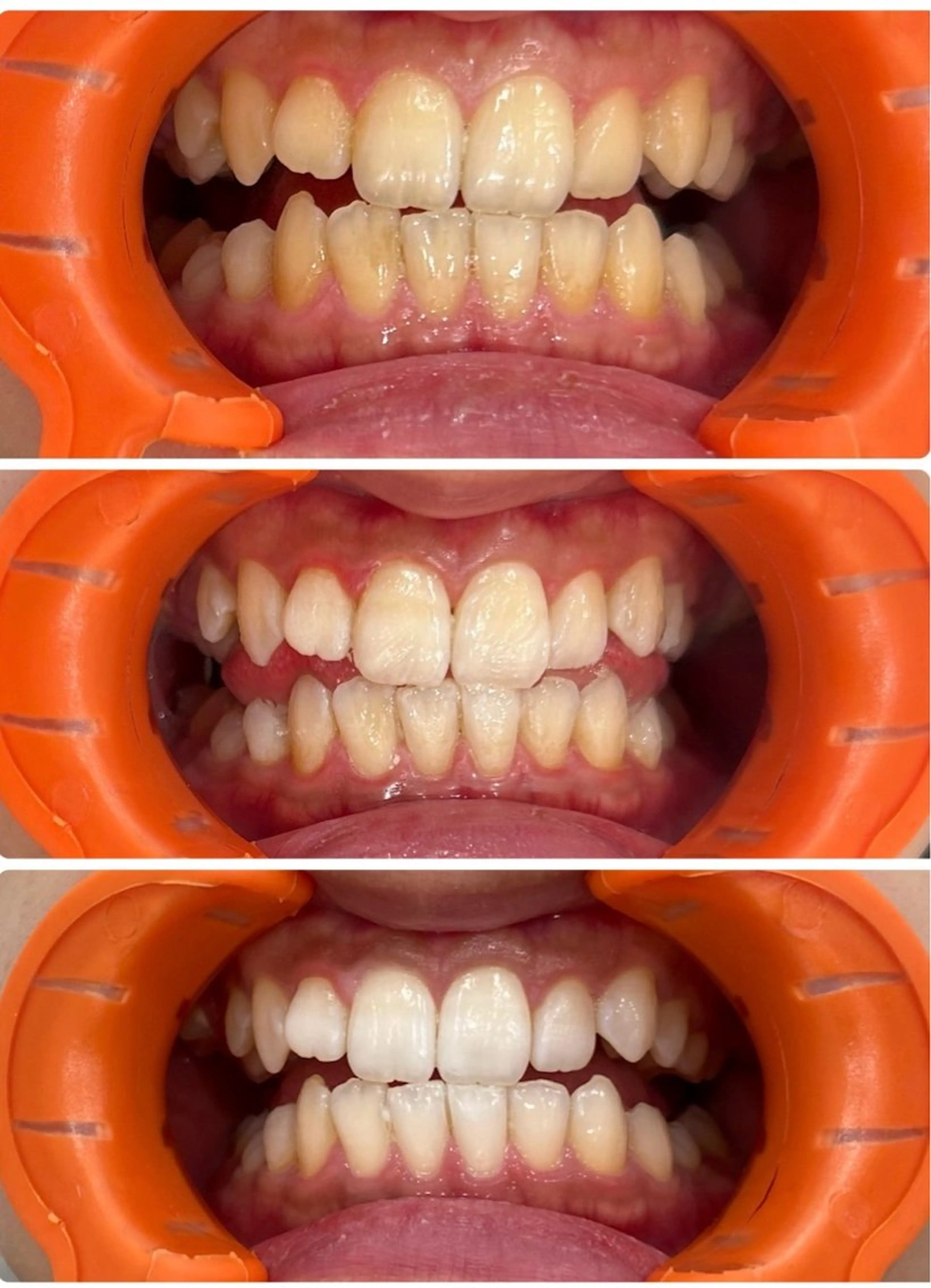 エステ ホワイトニング 神保町店/杉浦のエステ・リラクイメージ