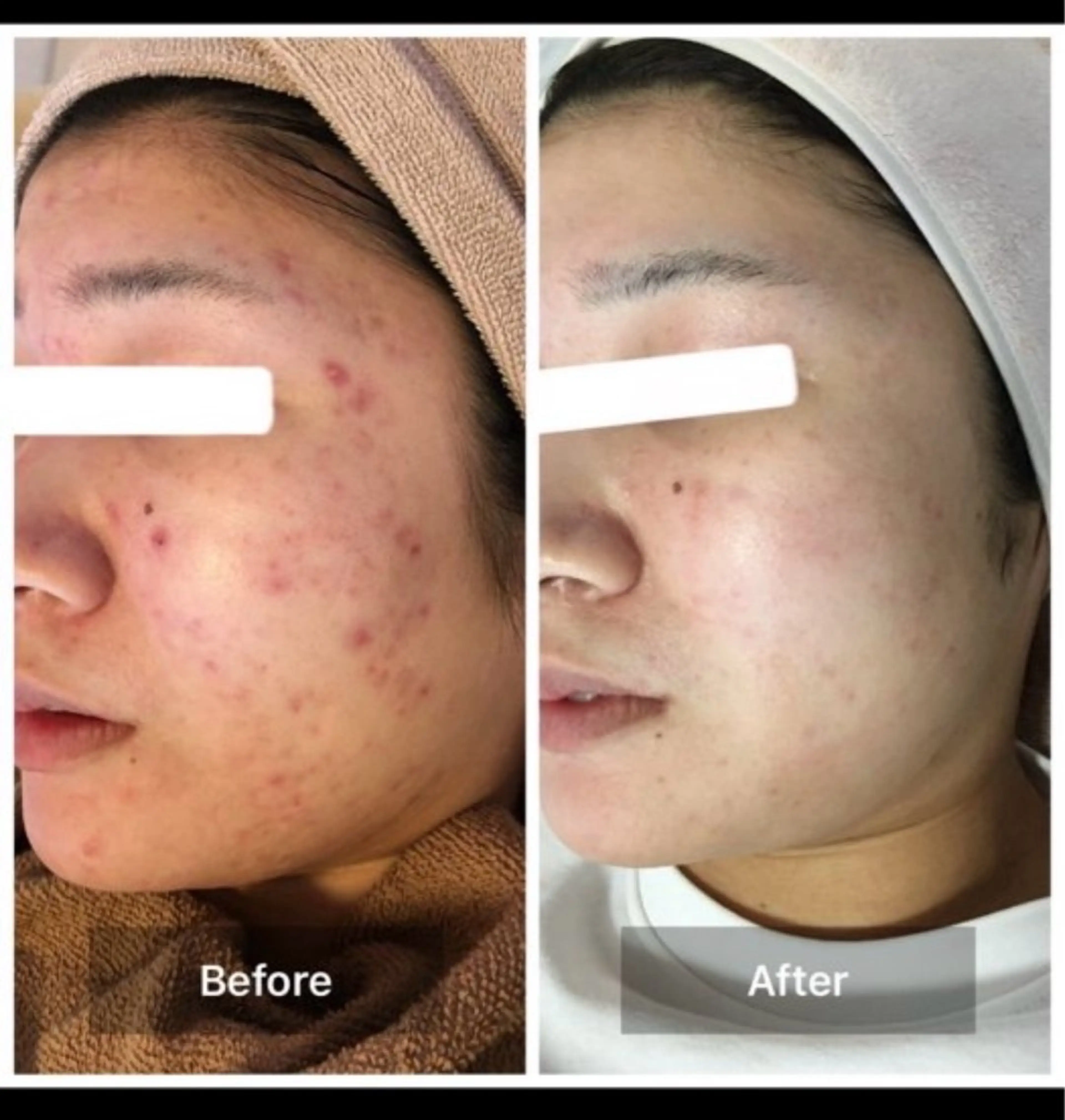 エステ ハーブピーリング 専門店MOKA所属・ハーブピーリング専門 MOKAのエステ・リラクイメージ