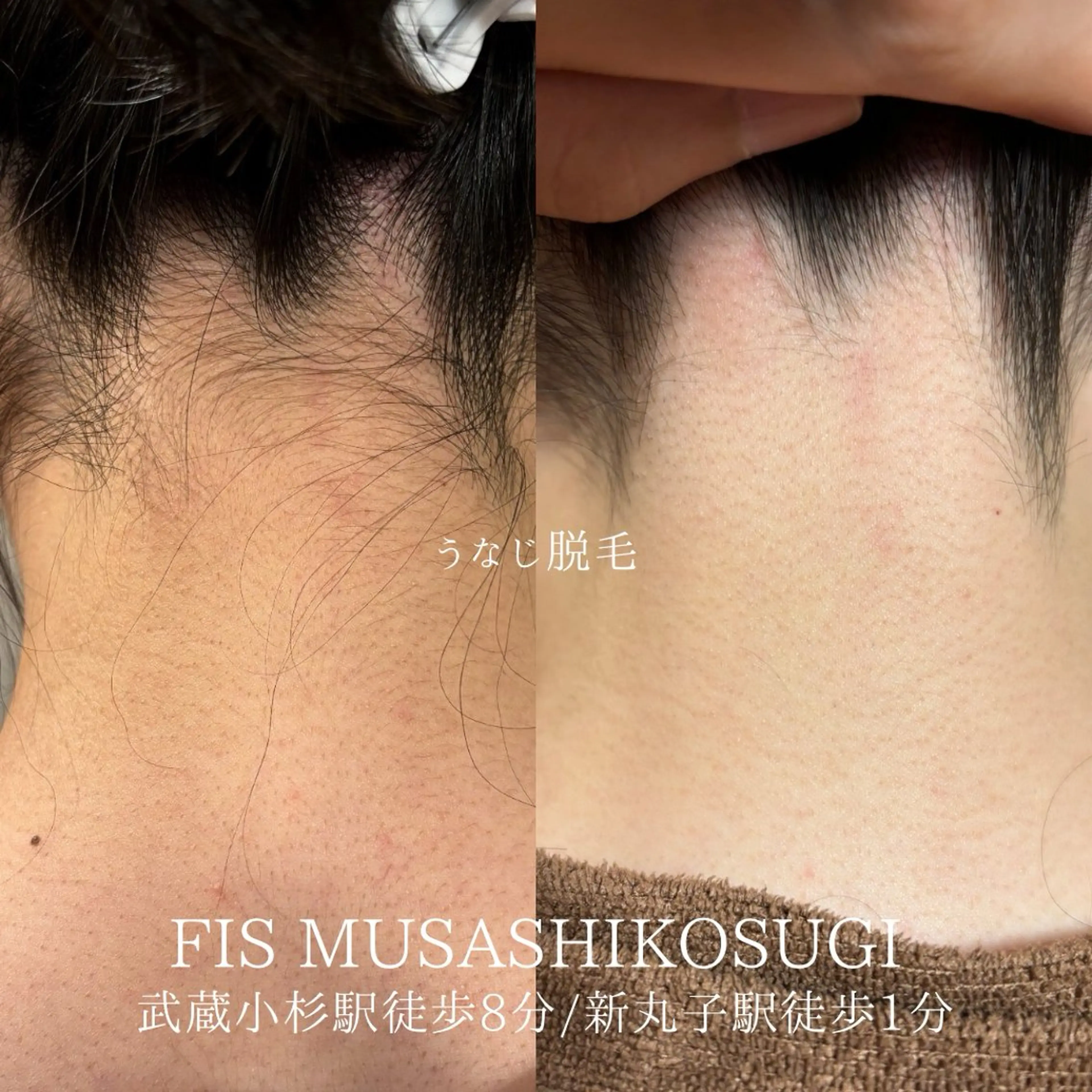 脱毛サロン FIS武蔵小杉店のエステ・リラクイメージ