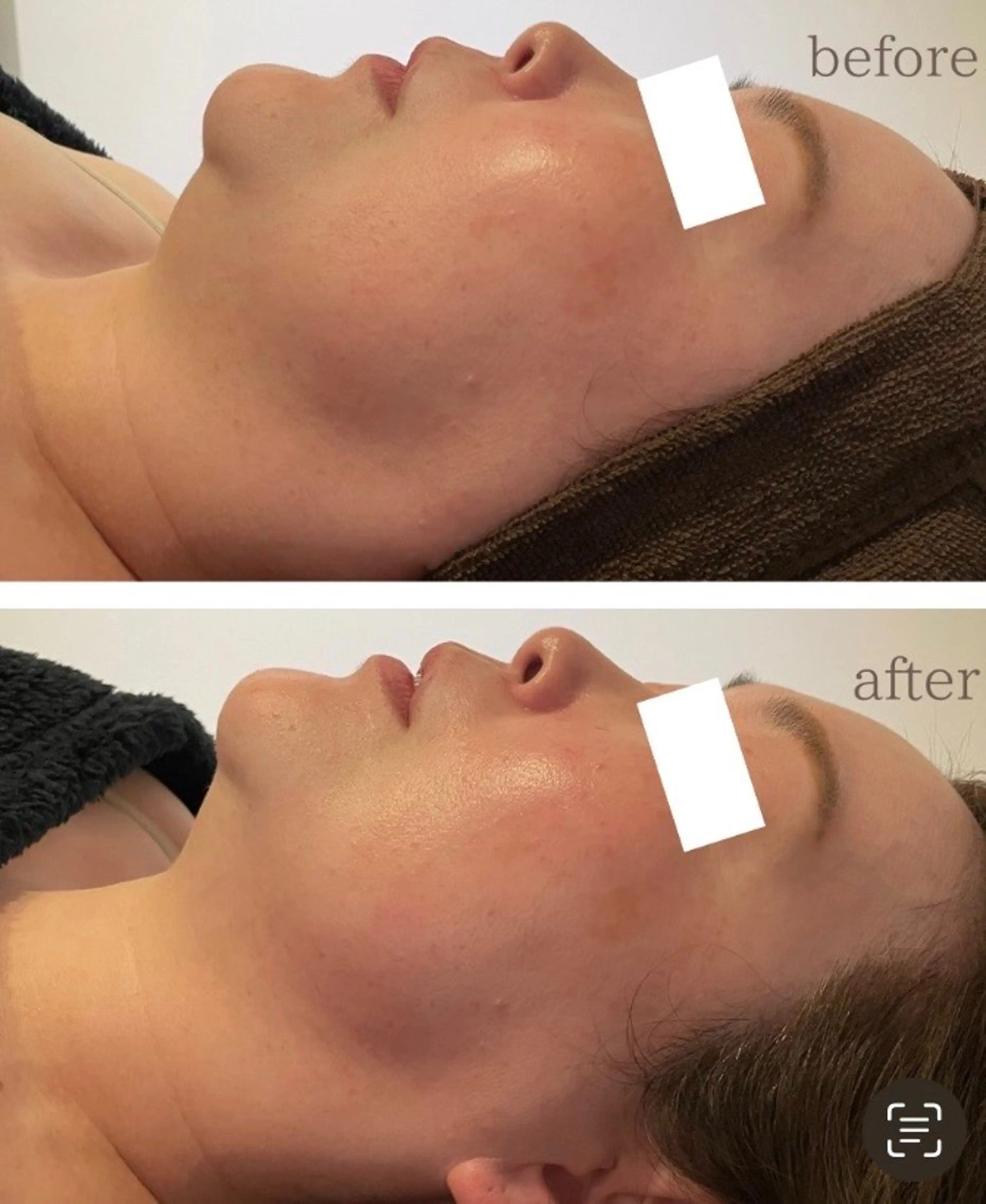 南森町・肌質改善 BELMIMARのエステ・リラクイメージ