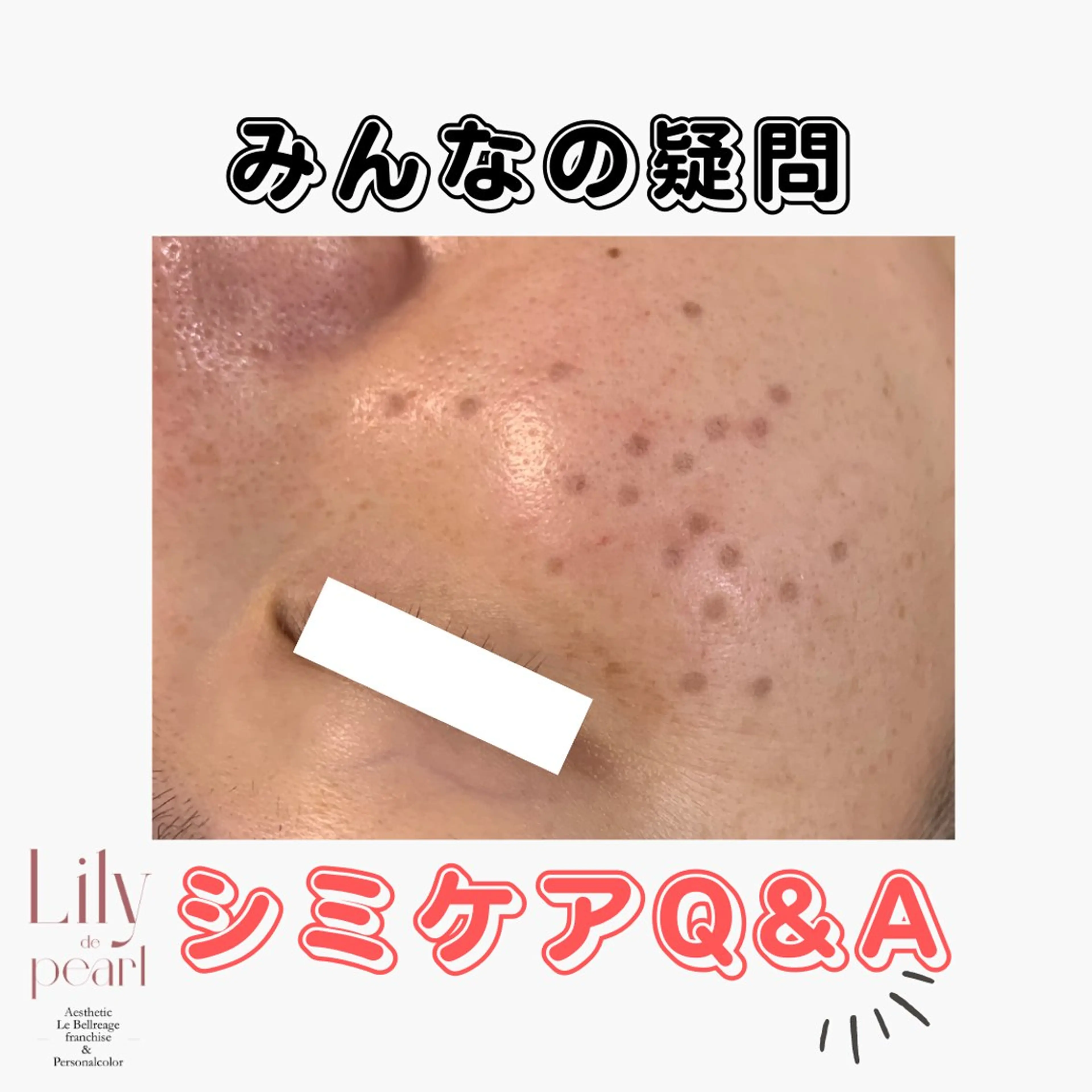 エステ 最新シミケアLily de pearlのエステ・リラクイメージ