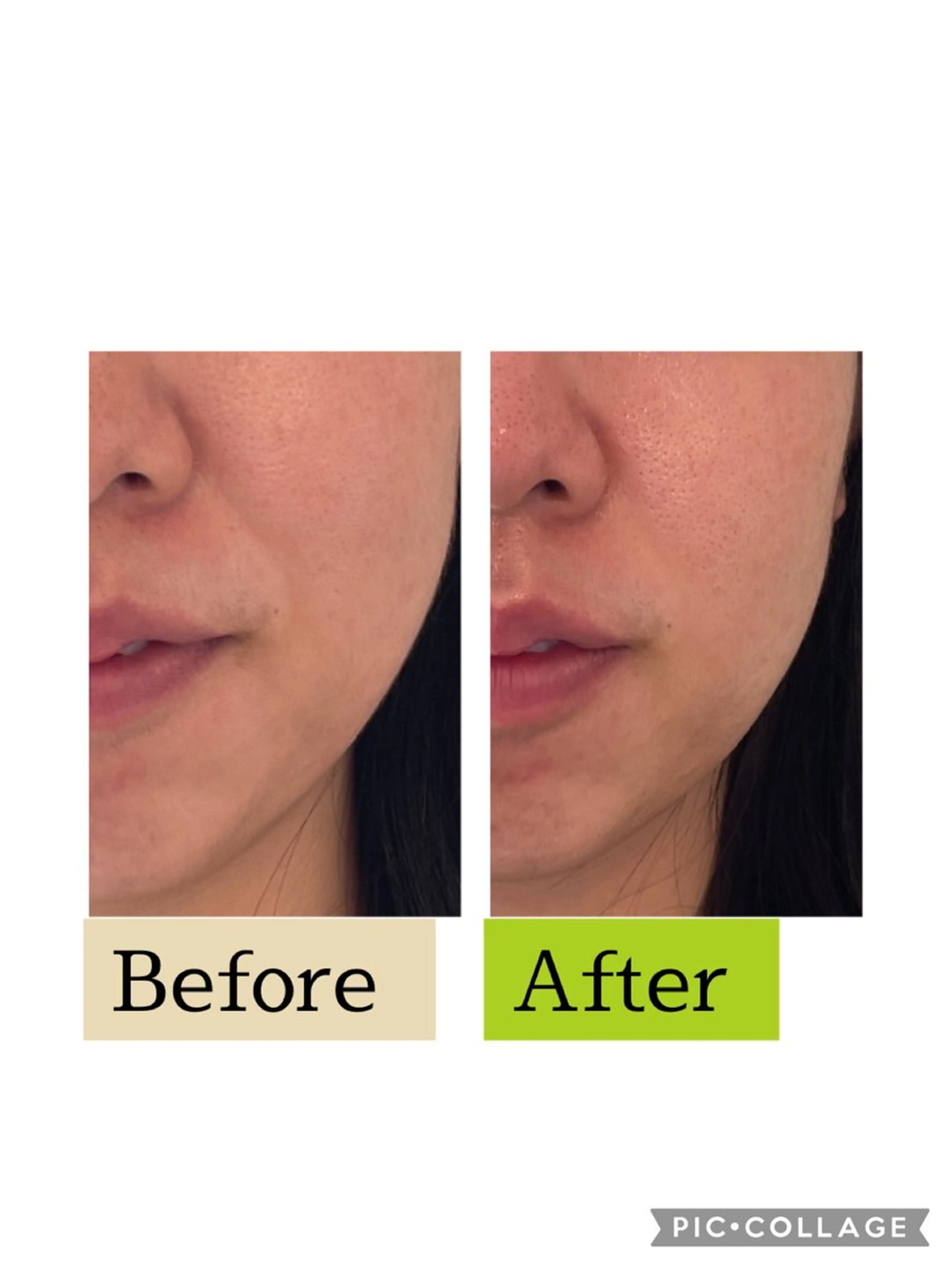 美肌サロン　ナゴミプラス所属・美肌とヘッド ナゴミプラスのエステ・リラクイメージ