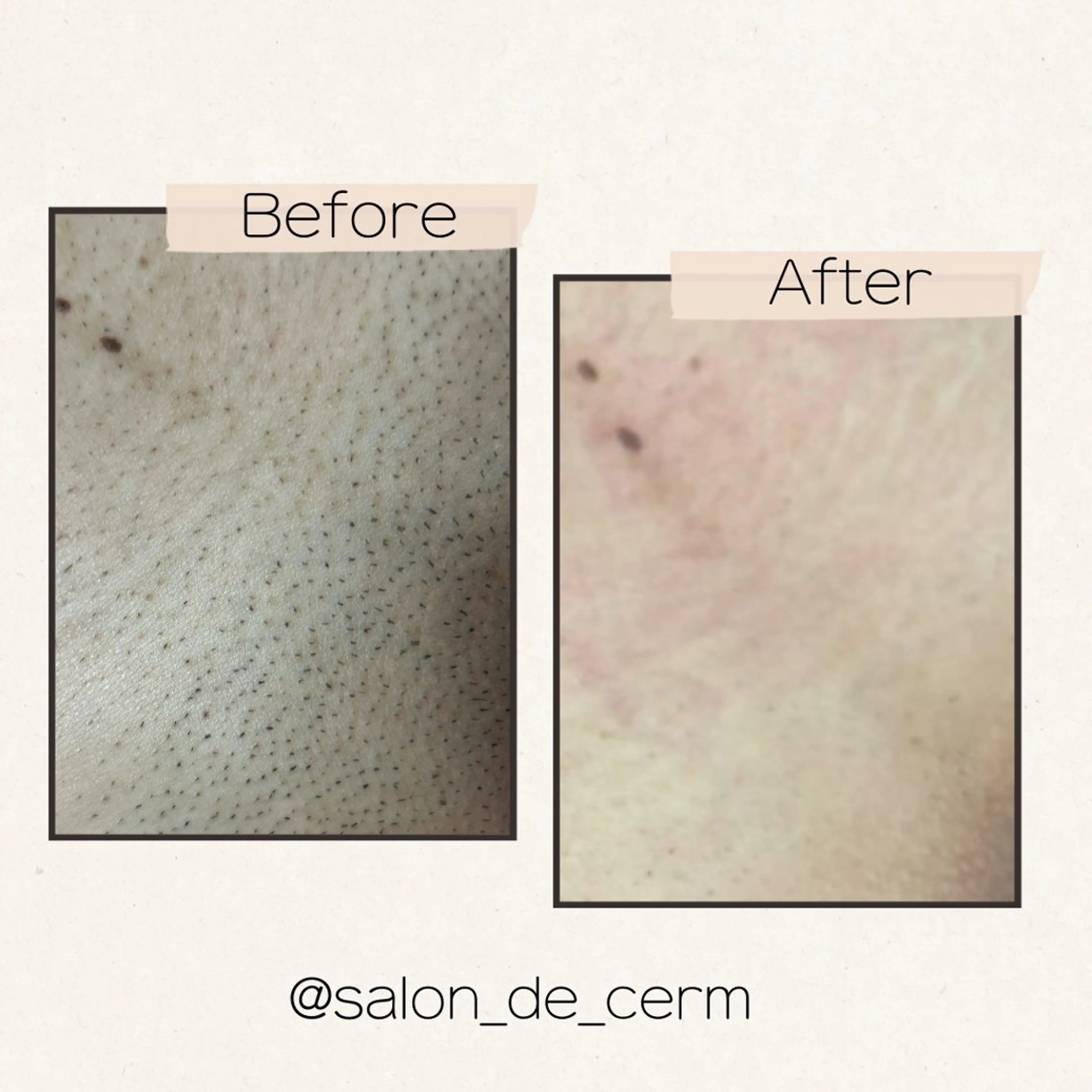 メンズ 脱毛 salon de cerm所属・CERM/心斎橋眉毛 /心斎橋HBLの眉毛・アイブロウイメージ