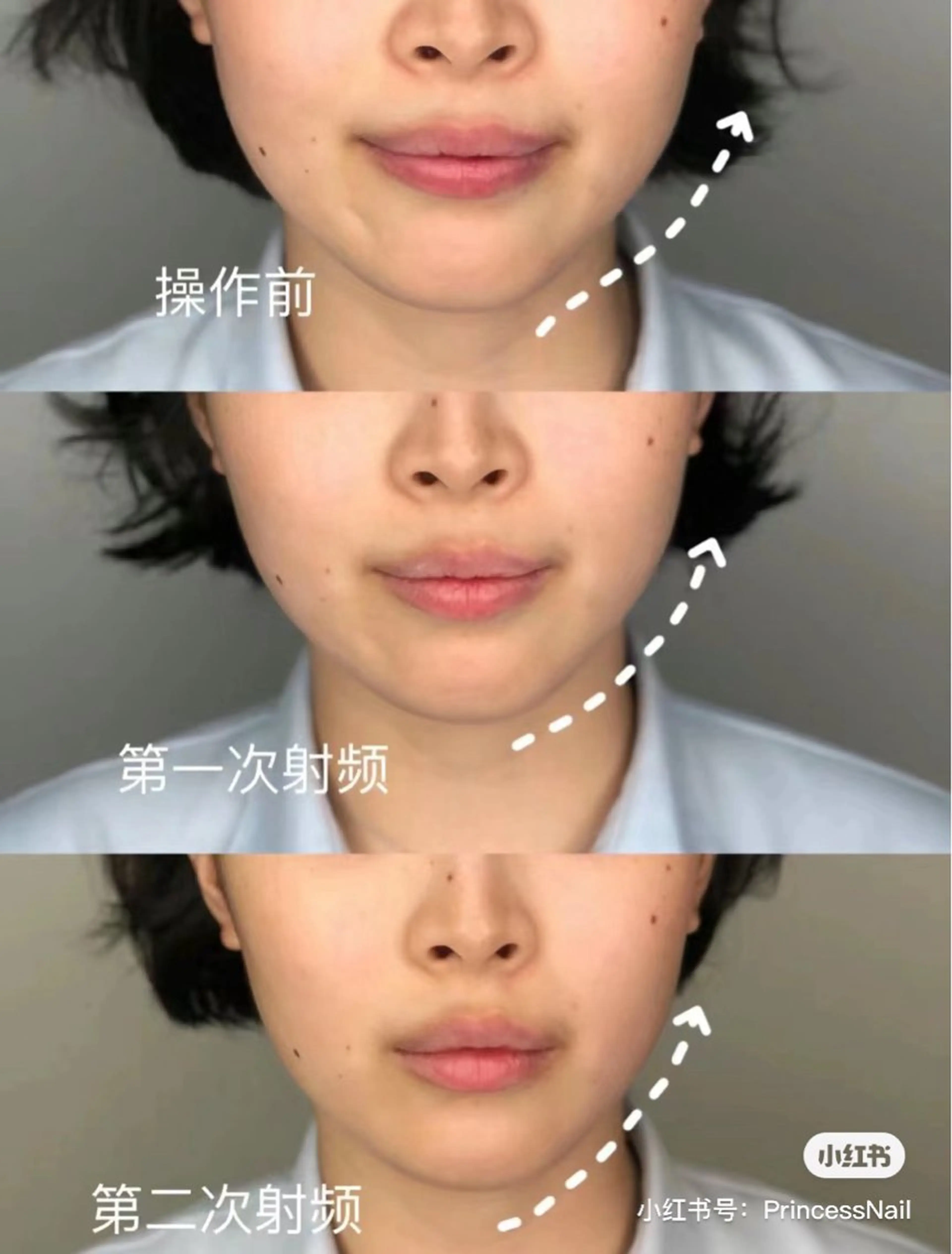 マツエク・マツパ 結婚式・ブライダル エステ aliaハーブ水光店 エステティシャン募集のエステ・リラクイメージ