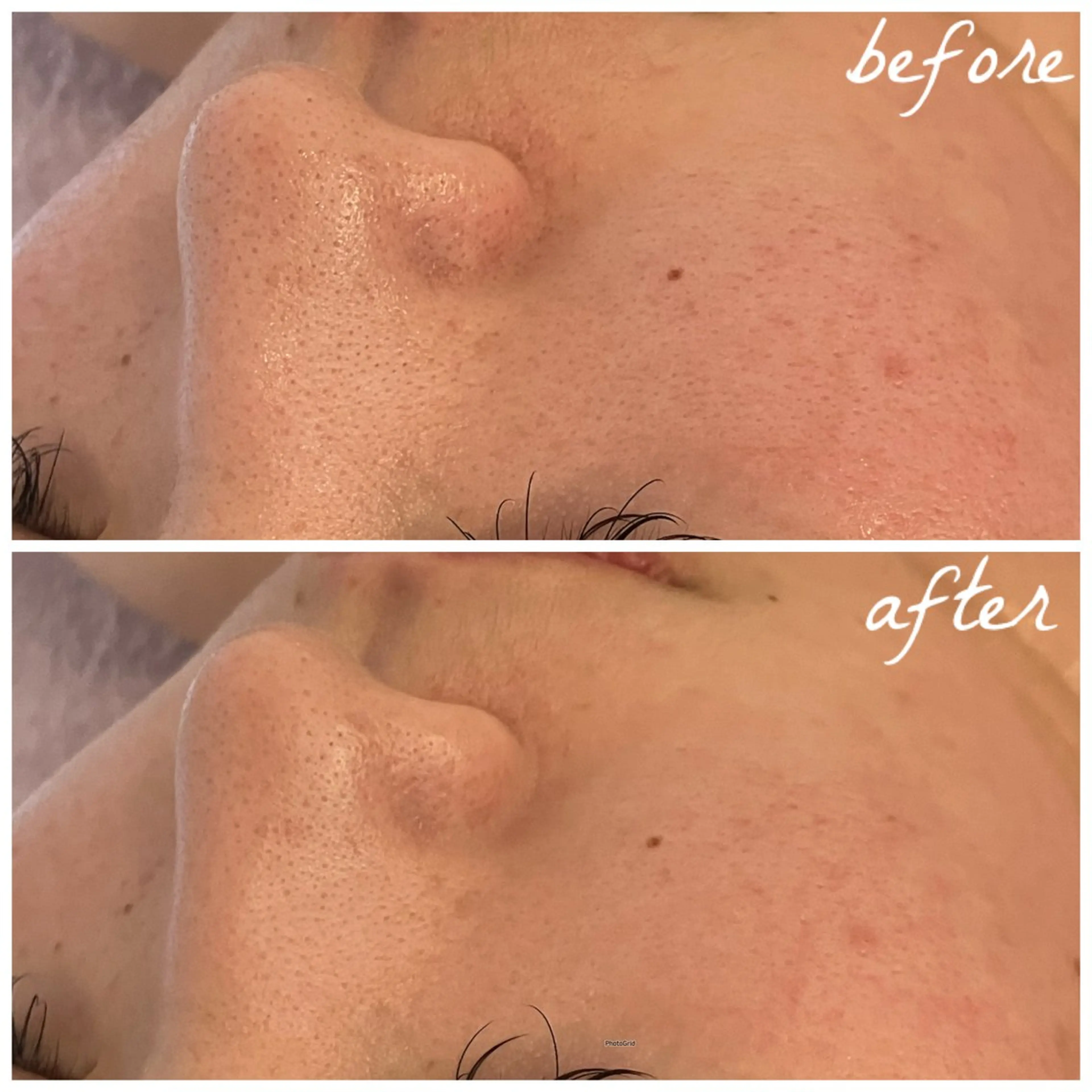 メンズ エステ メナード岐阜市茜部 杉浦のエステ・リラクイメージ