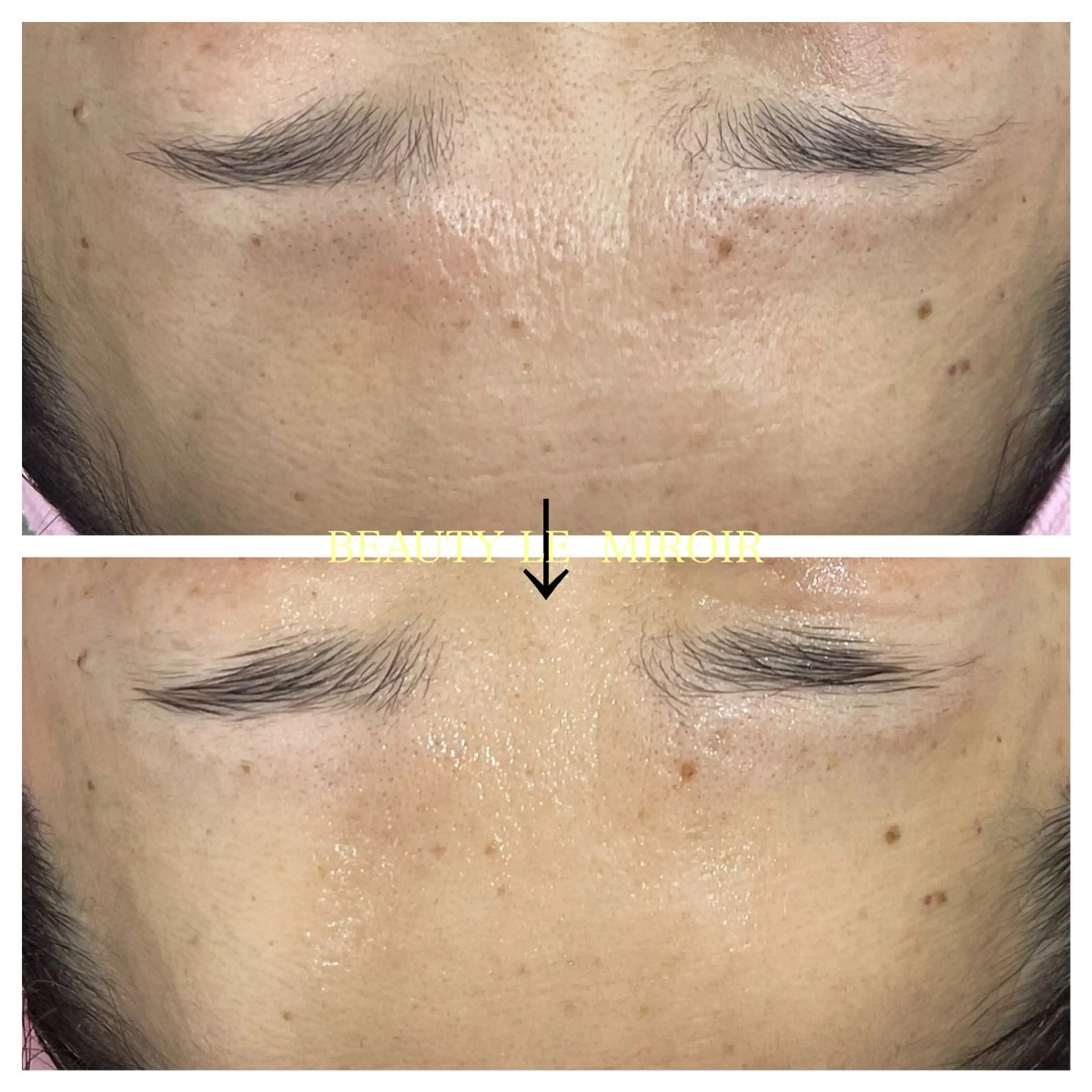 エステ ビューティー ミロワールのエステ・リラクイメージ