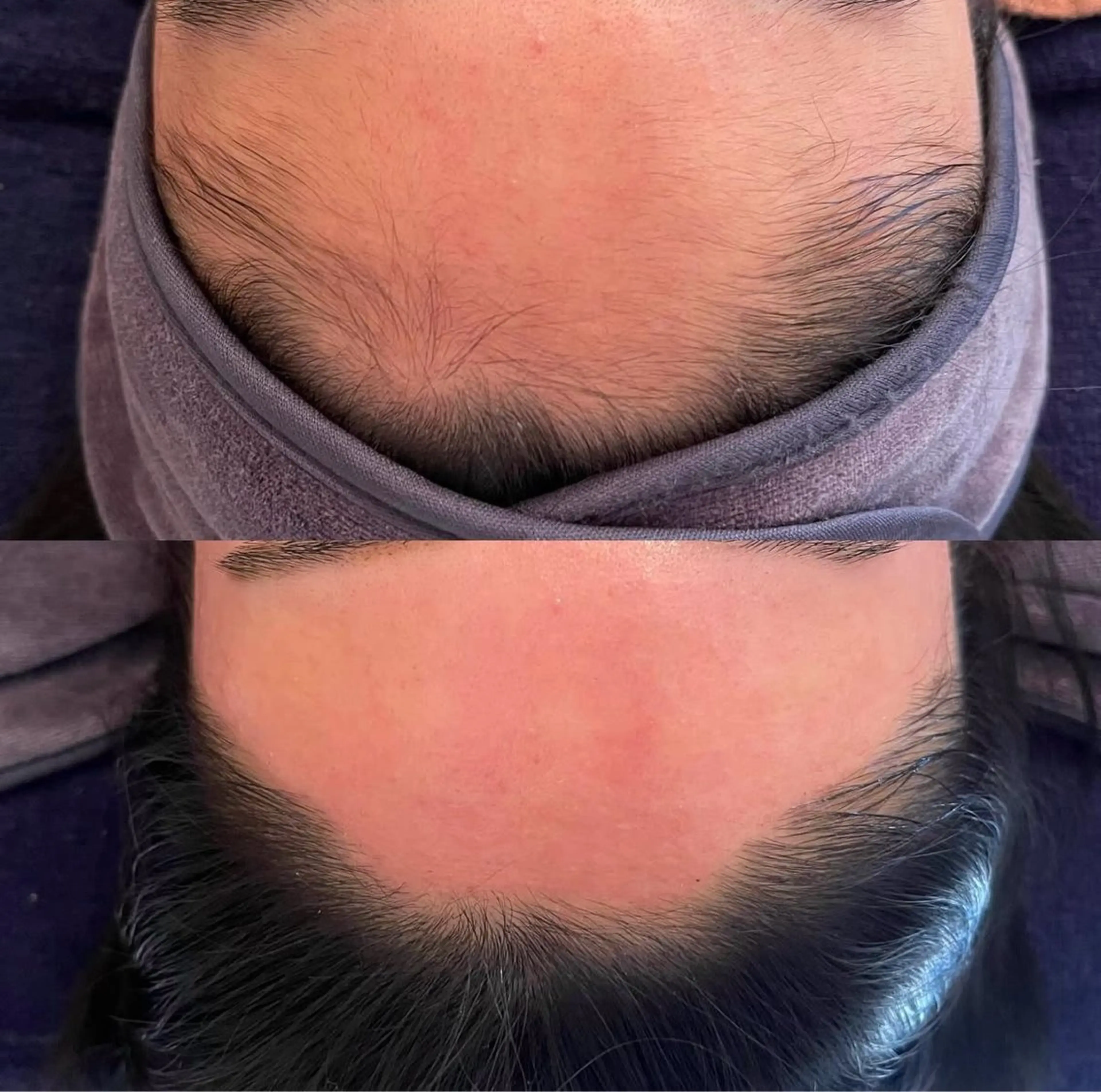 脱毛 ソワン ボーテのマツエク・マツパデザイン