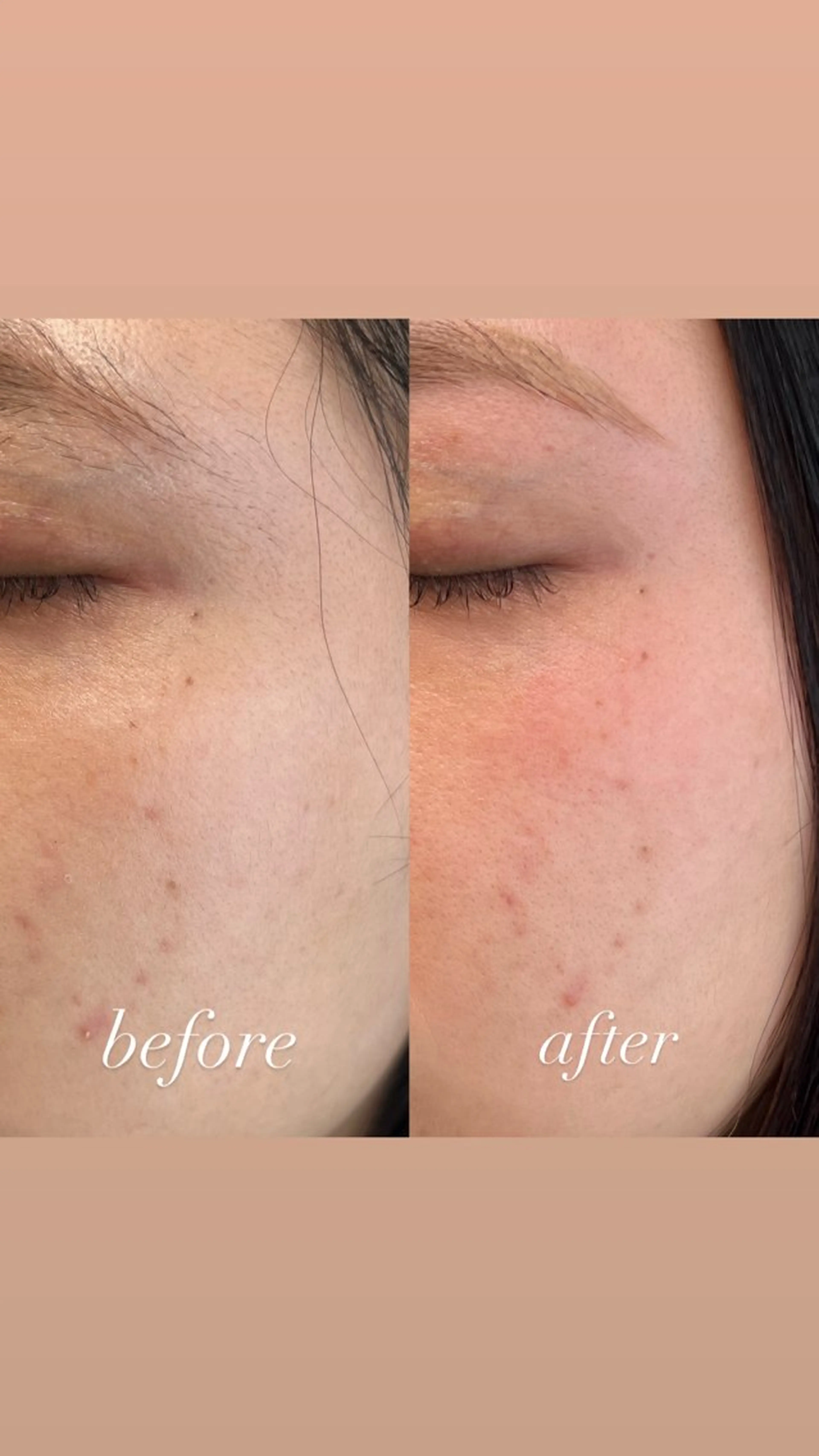 アイブロウ ワックス脱毛 眉カット その他(アイブロウ) 眉毛専門店スタッフ kanakoの眉毛・アイブロウイメージ