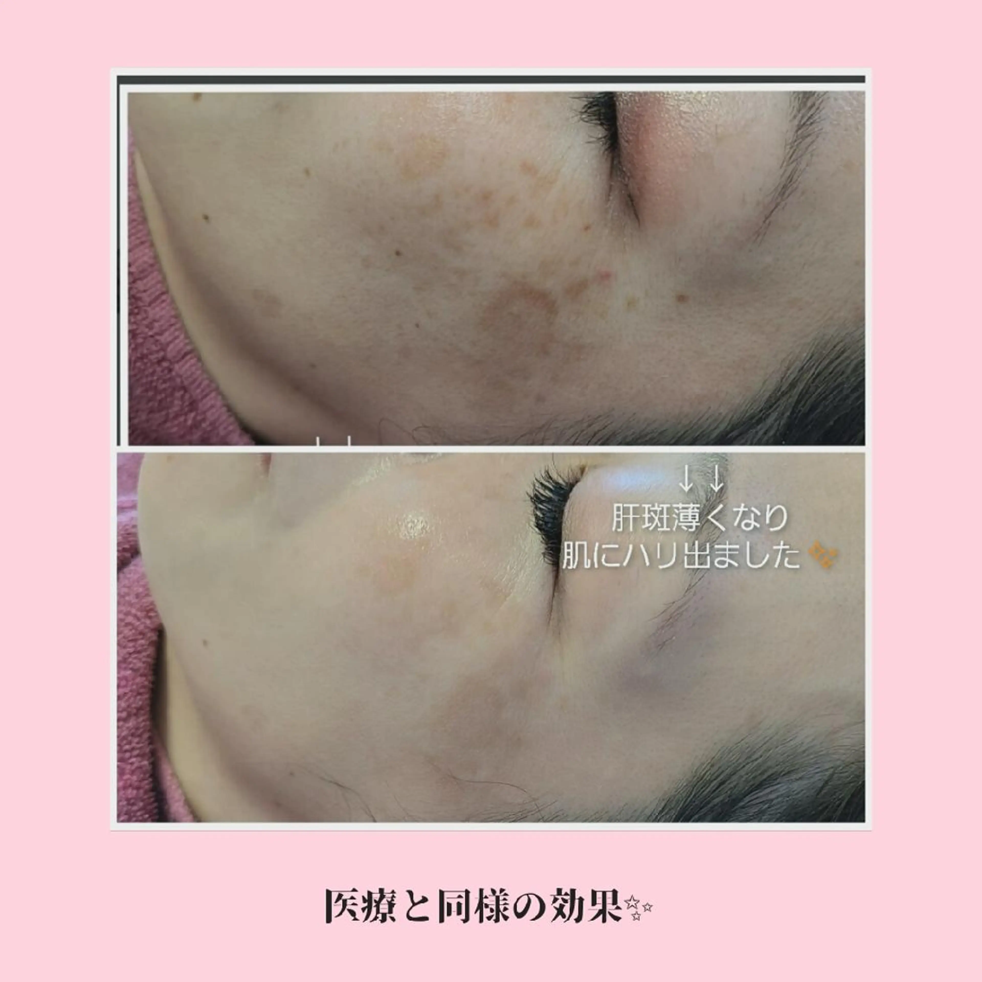 エステ 【トータル美容】 Eternityのその他イメージ