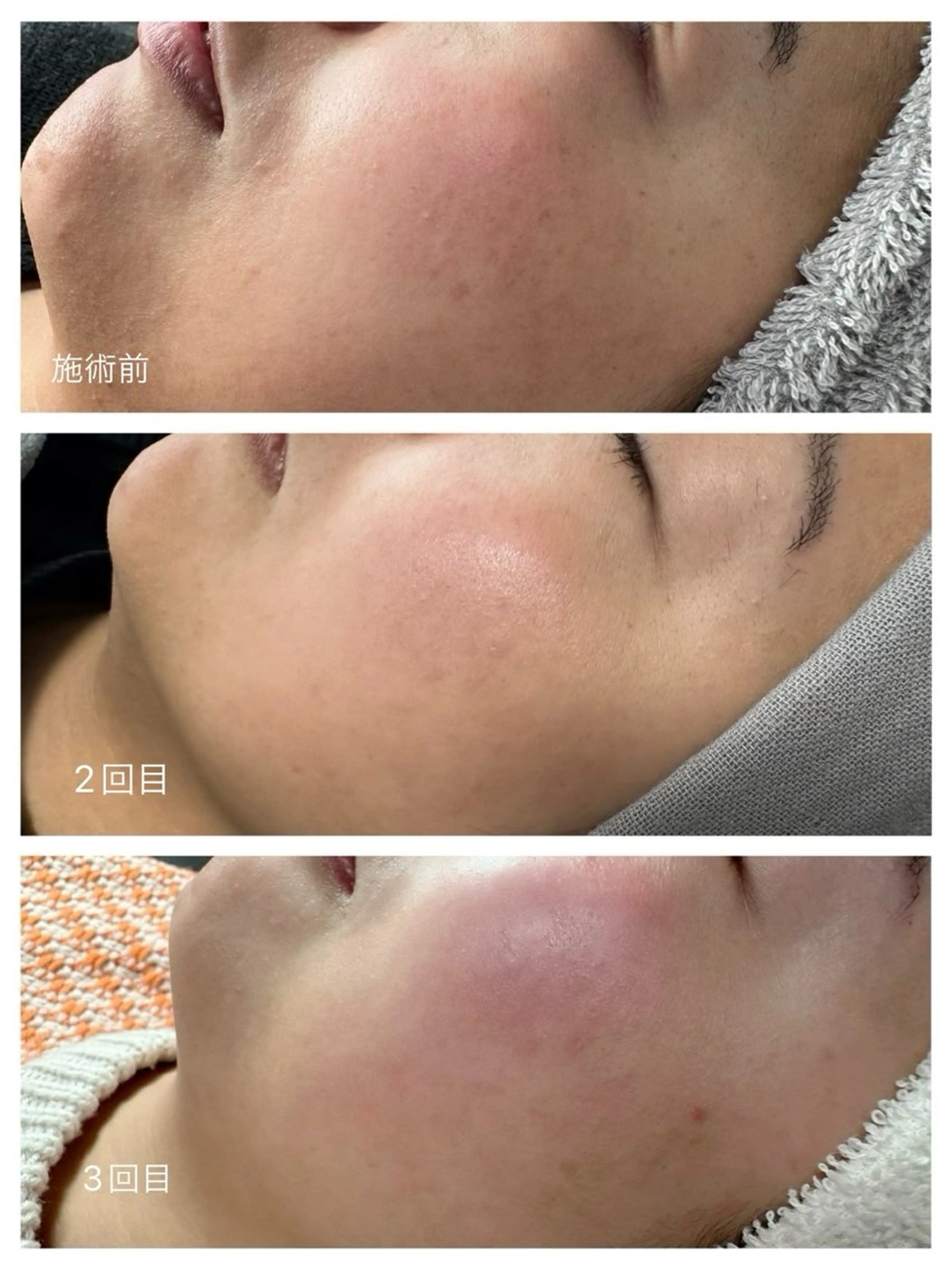 マツエク・マツパ SAYAKA 🫧のマツエク・マツパデザイン