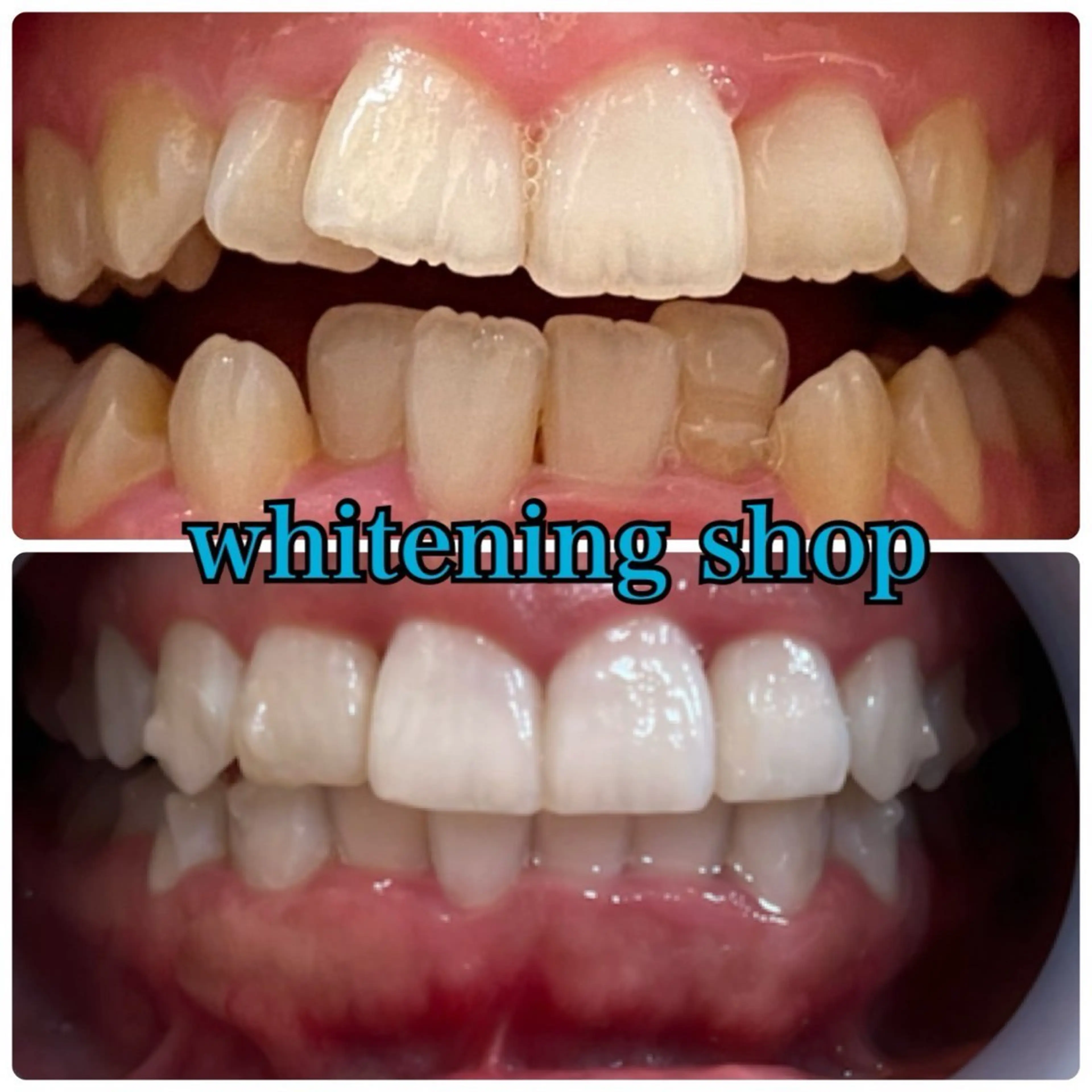 メンズ エステ リラク ホワイトニング ショップ川越店のエステ・リラクイメージ