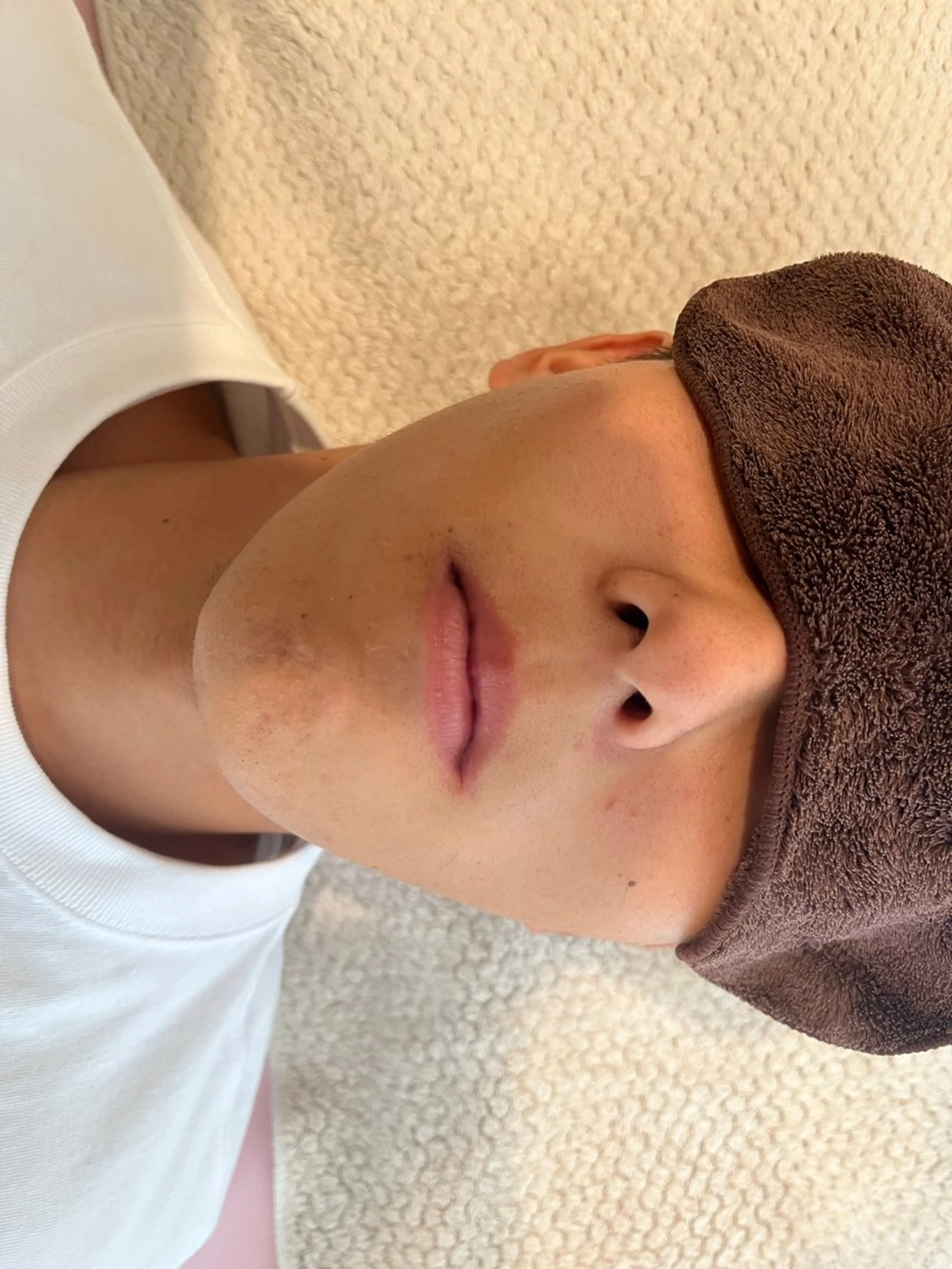 ヒゲ脱毛初回3300円、男性スタッフが担当できますの写真