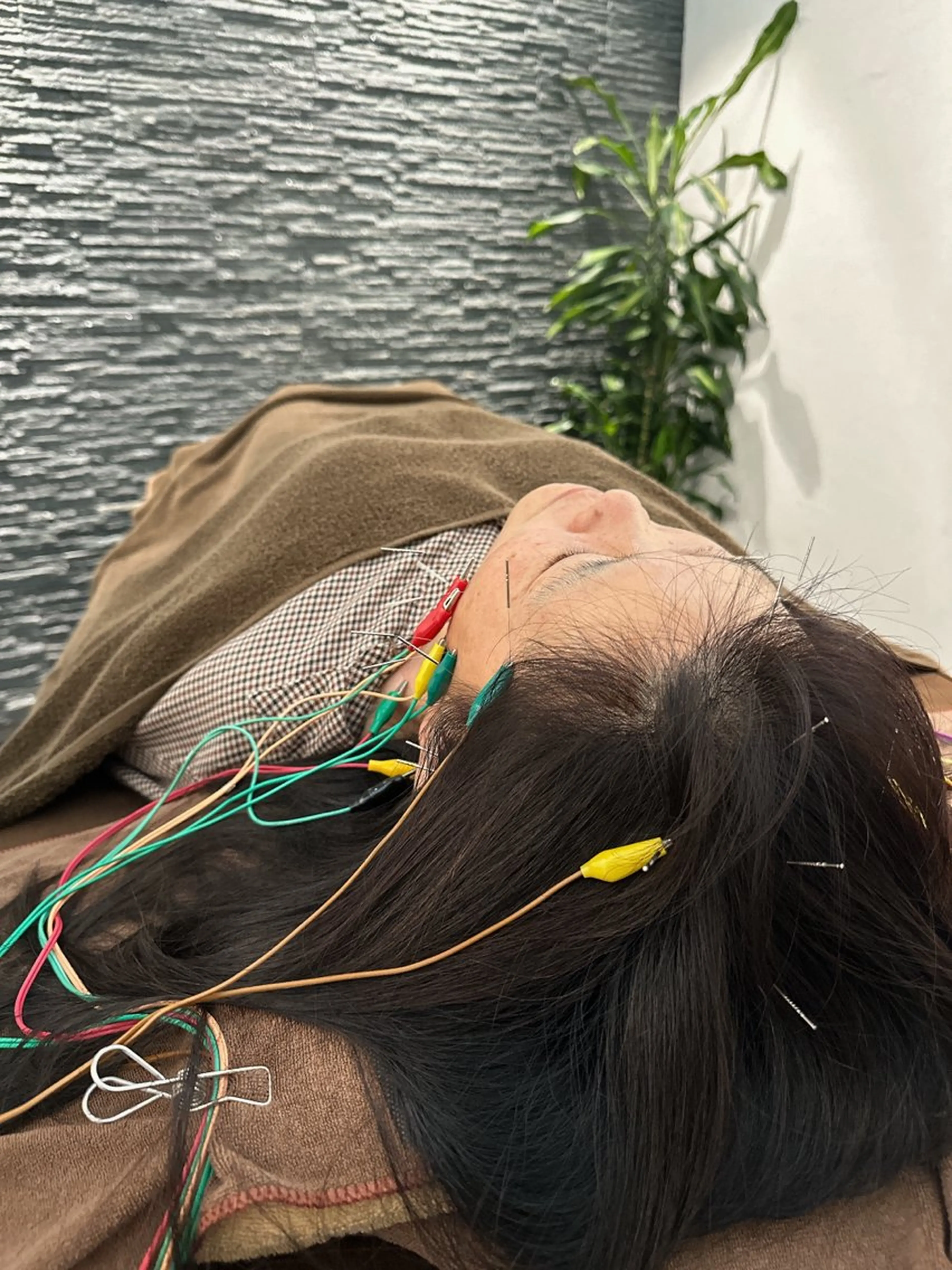 その他 美容鍼灸整体サロンBeauJu所属・小顔矯/美容鍼/鍼灸 BeauJuのその他イメージ