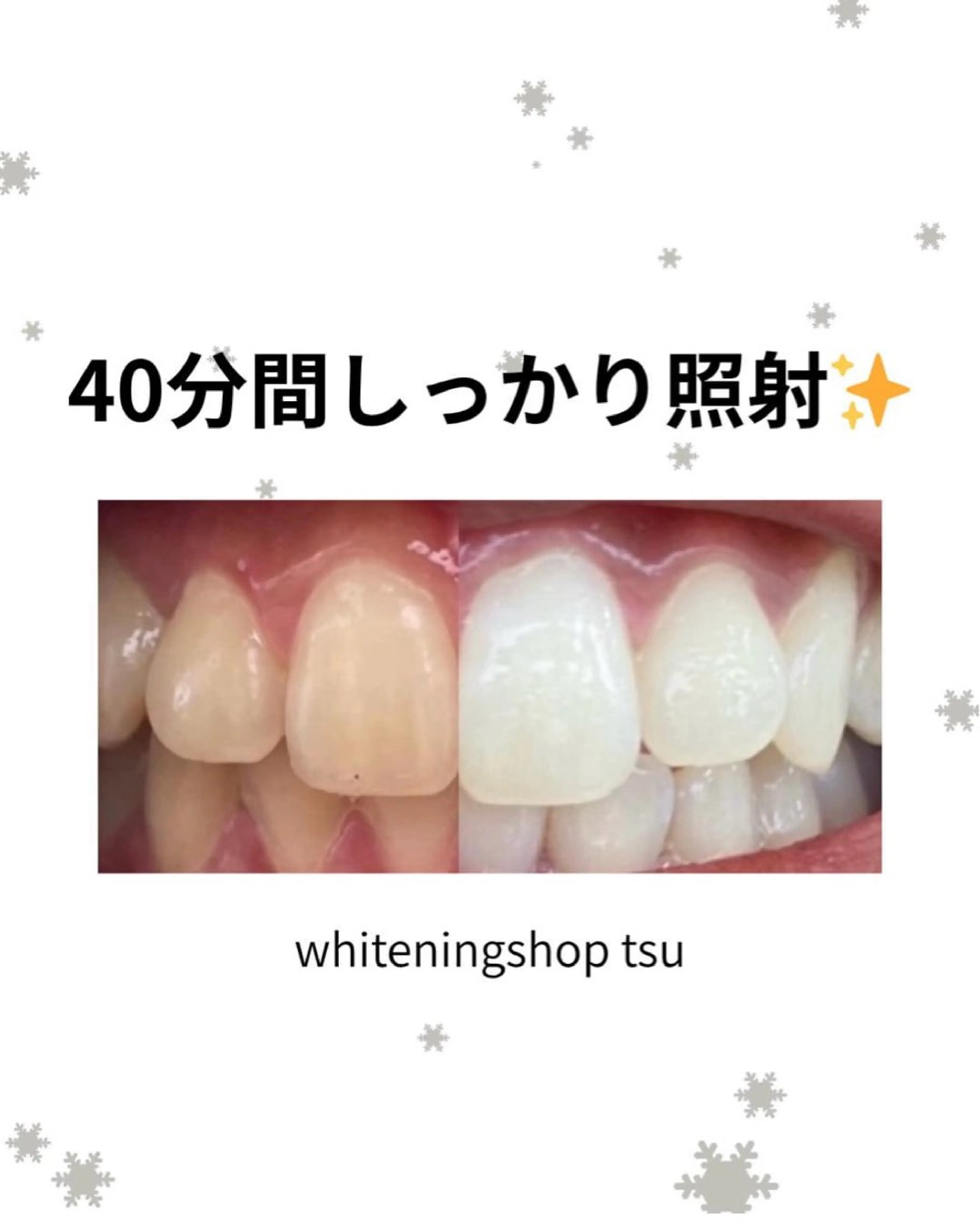 その他 ホワイトニング ショップ津店のその他イメージ