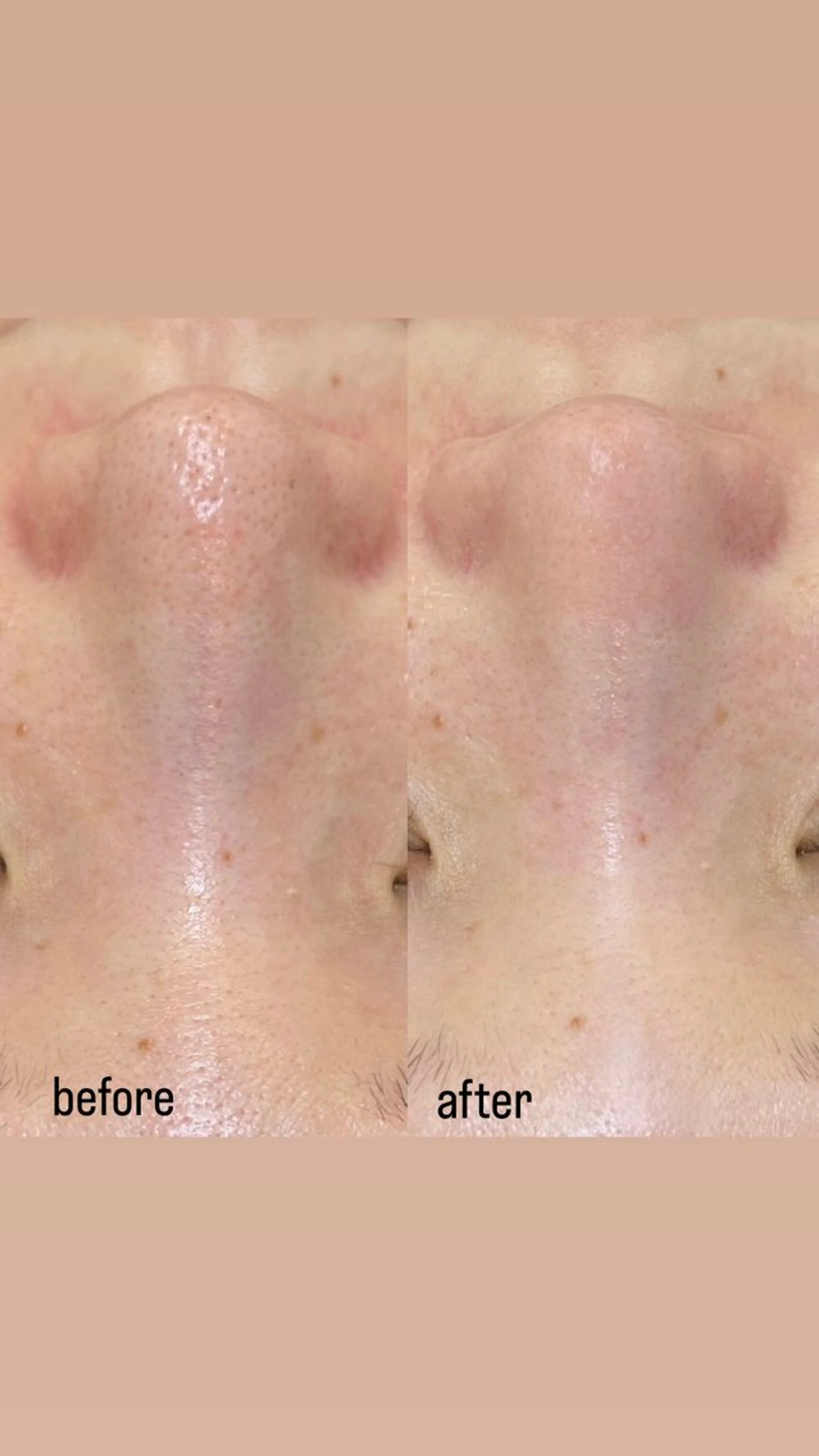 エステ プライベートサロン リプレイスのエステ・リラクイメージ