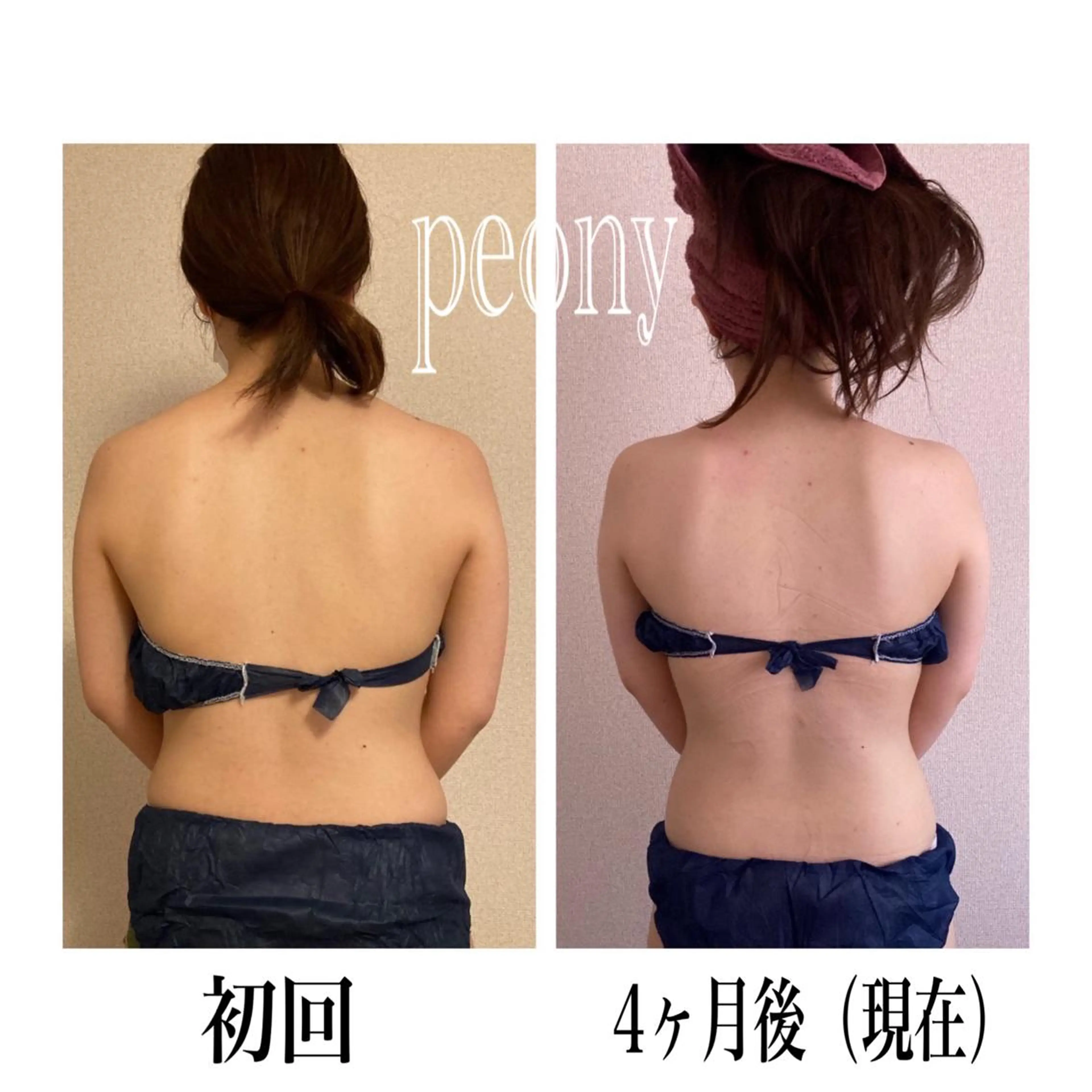 デトックス美容専門サロンｐｅｏｎｙ所属・デトックス美容専門 サロンｐｅｏｎｙのエステ・リラクイメージ