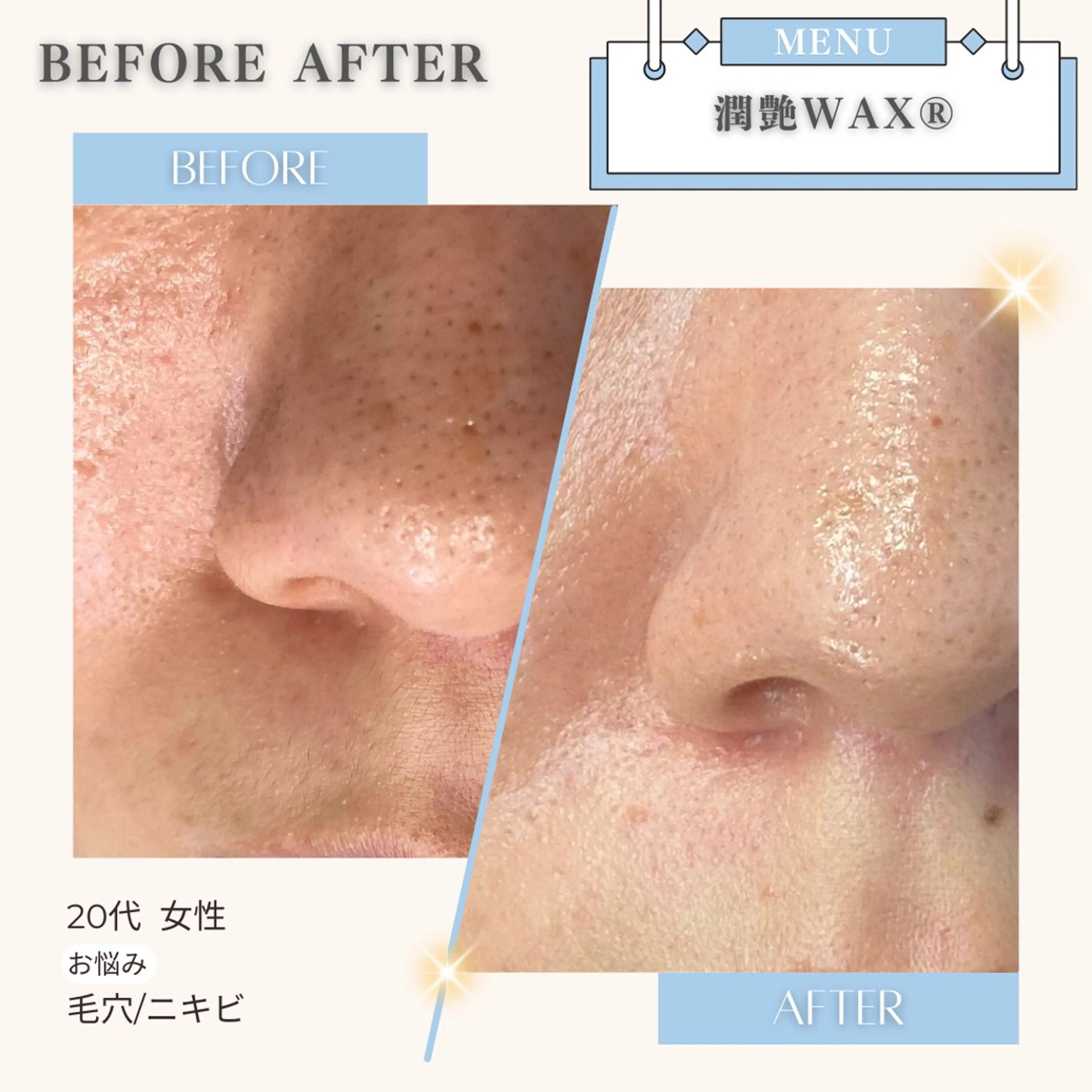 脱毛 美白/韓国肌管理 💎 KOTOMIのエステ・リラクイメージ