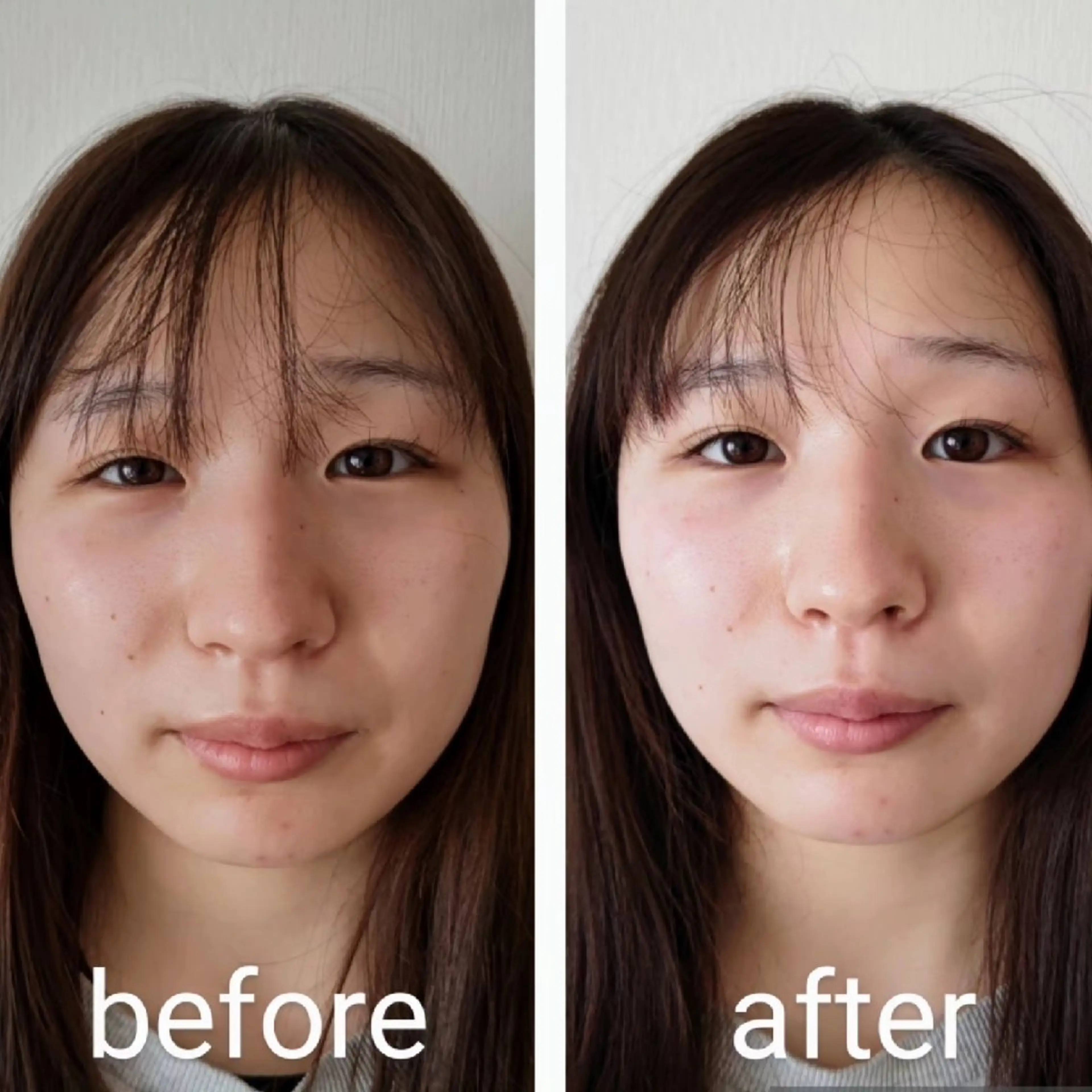 小顔矯正夙川 カレーズのエステ・リラクイメージ