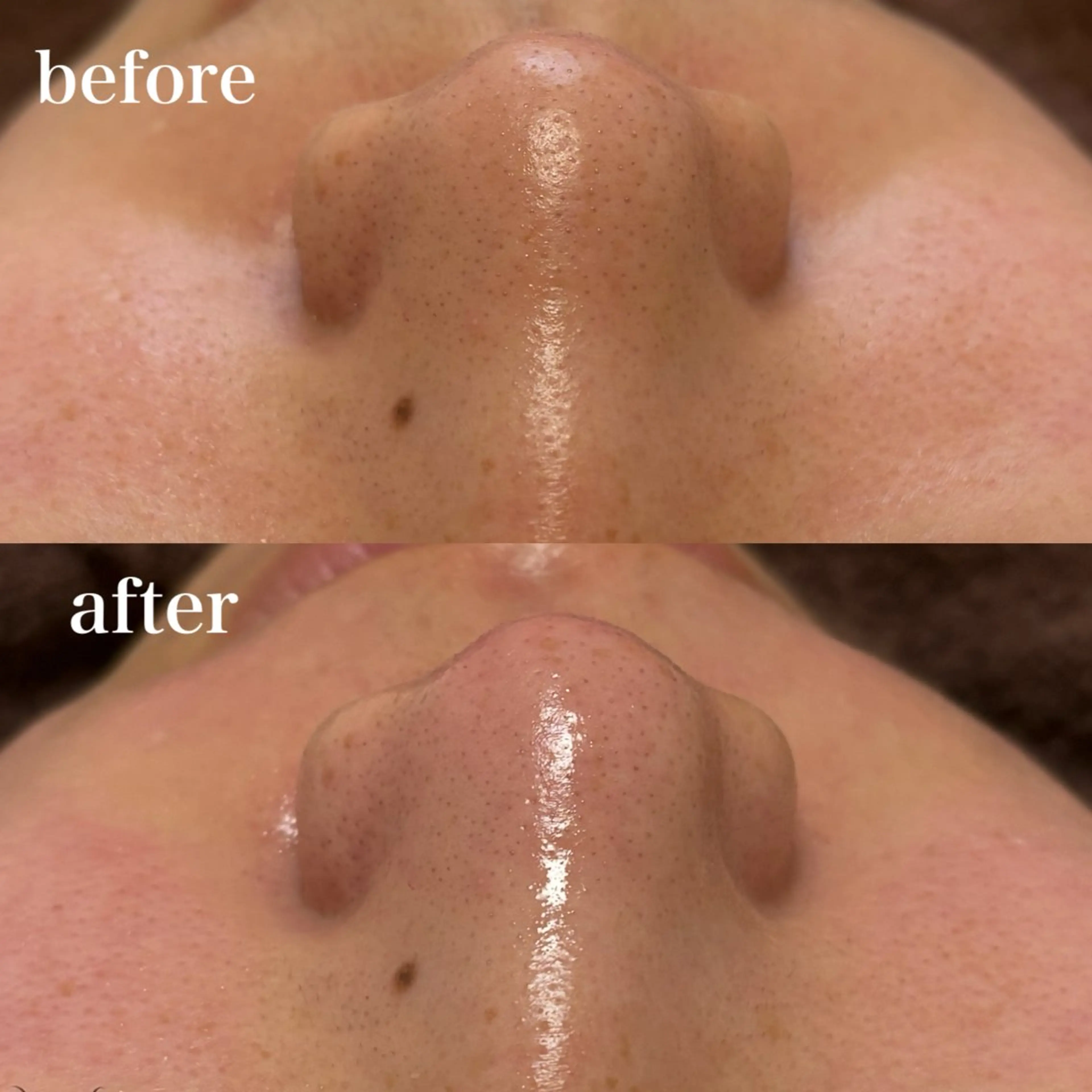 つい触りたくなる👀艶モチ肌💧毛穴洗浄+フェイシャルワックス🪞口コミ価格👀の写真