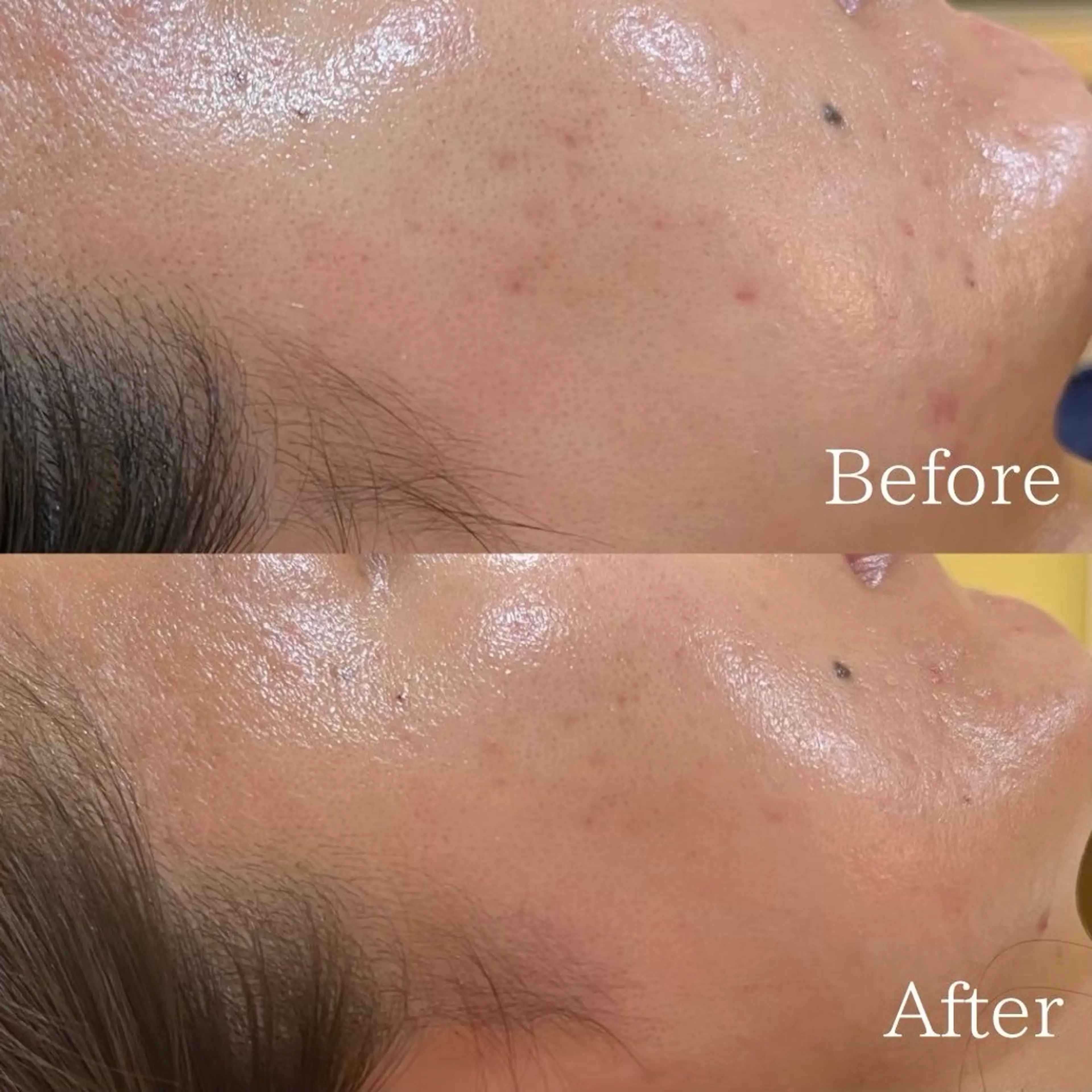 エステ 毛穴改善サロン d'Alba大阪住吉のエステ・リラクイメージ