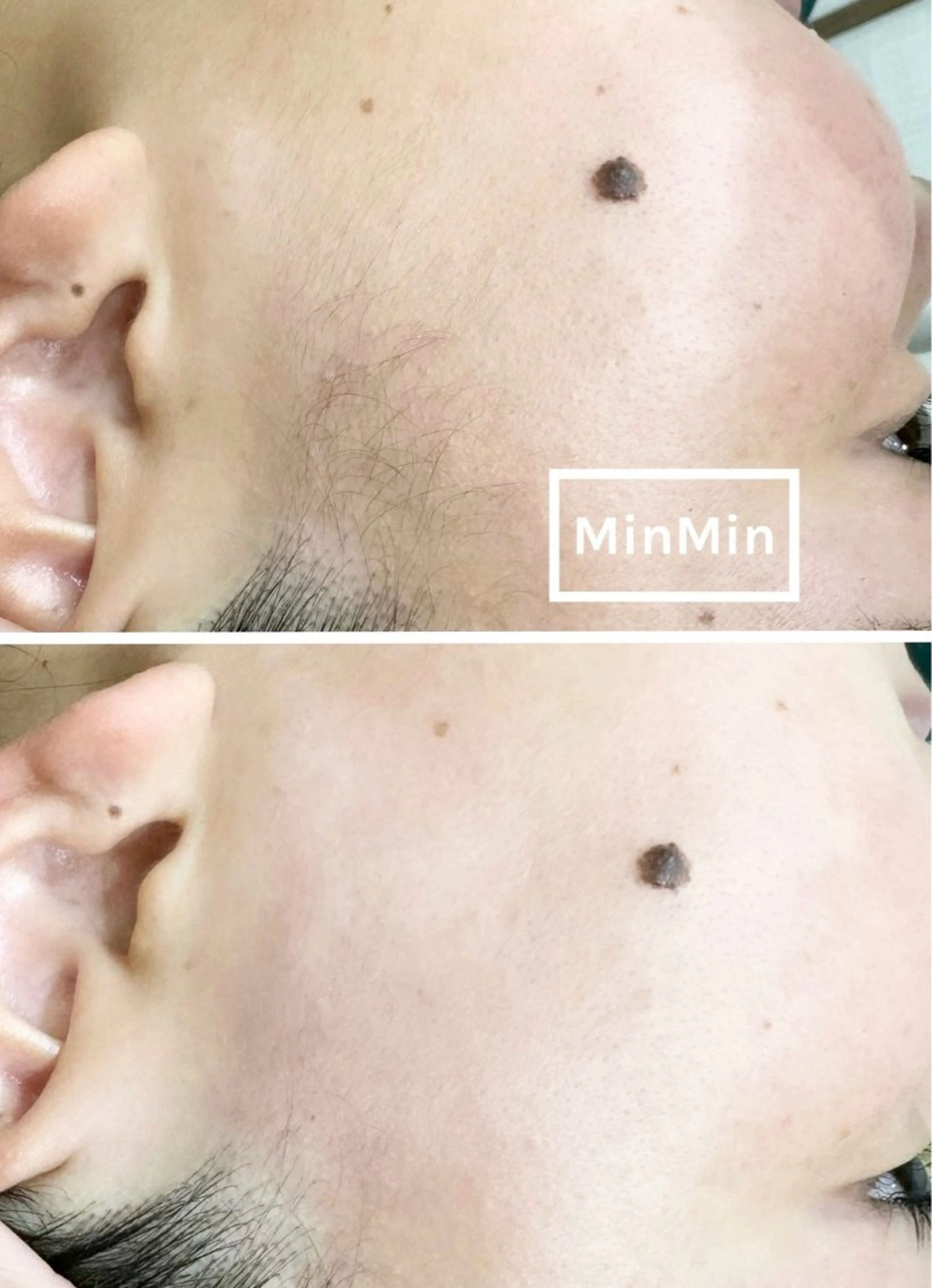 TReiS eyelashのマツエク・マツパデザイン