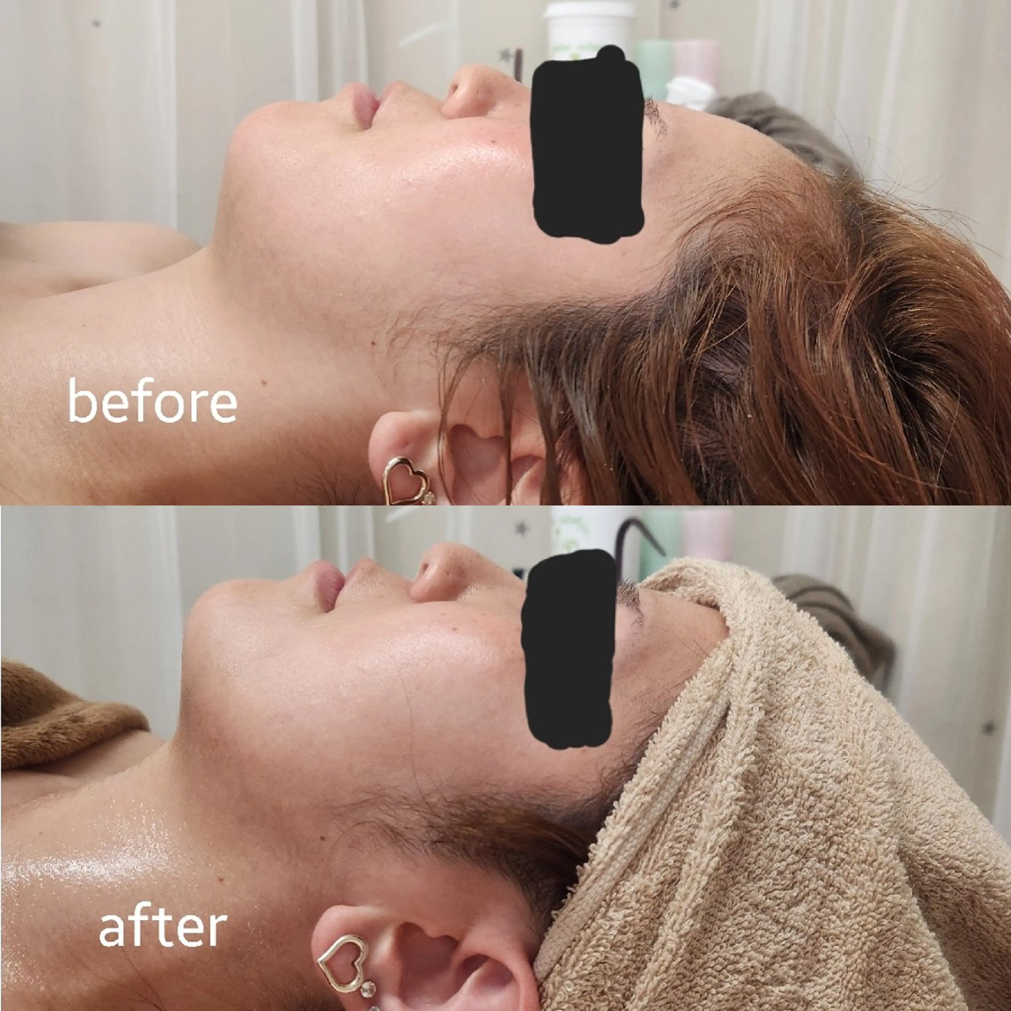 Shiny ✧︎*。のエステ・リラクイメージ