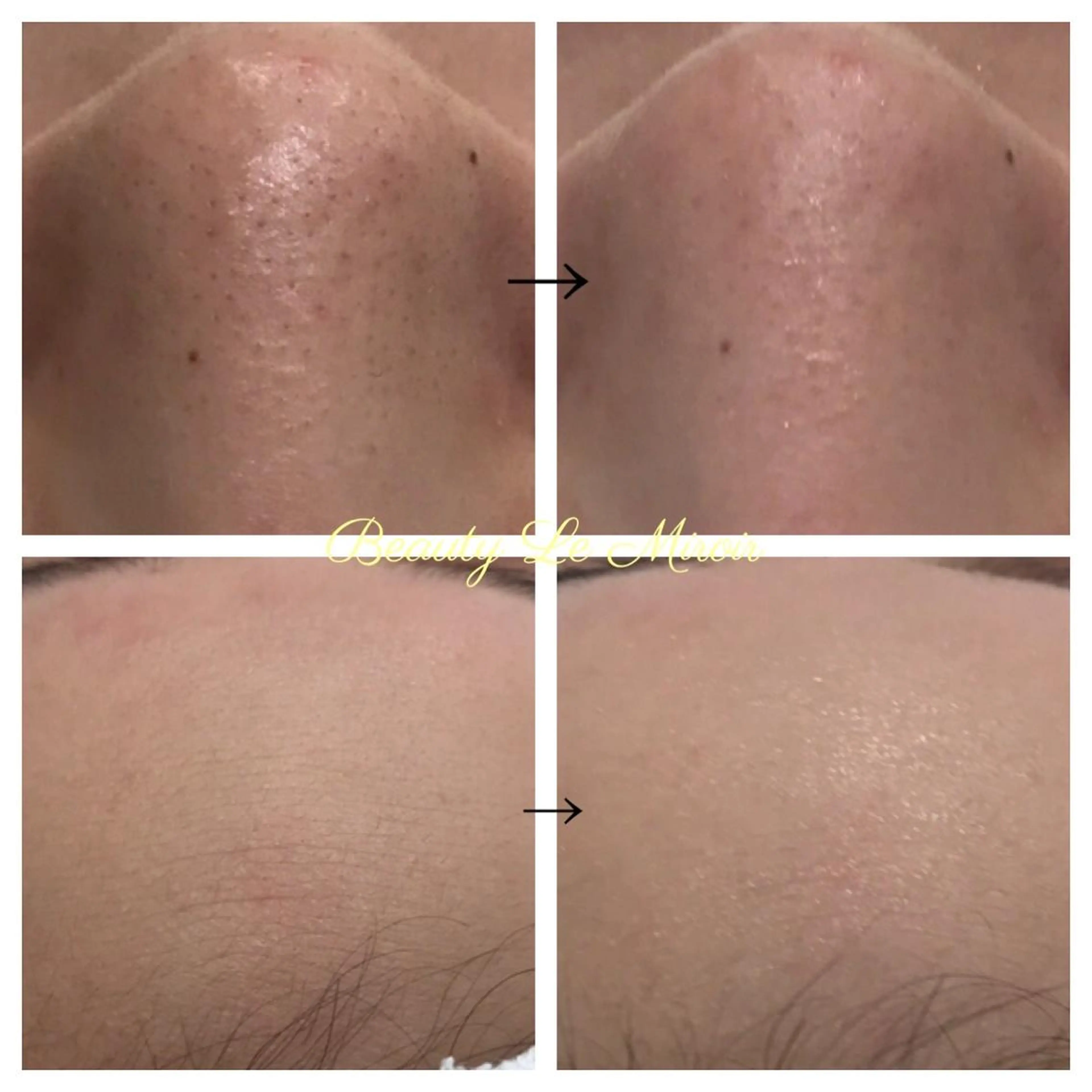 ビューティー ミロワールのエステ・リラクイメージ