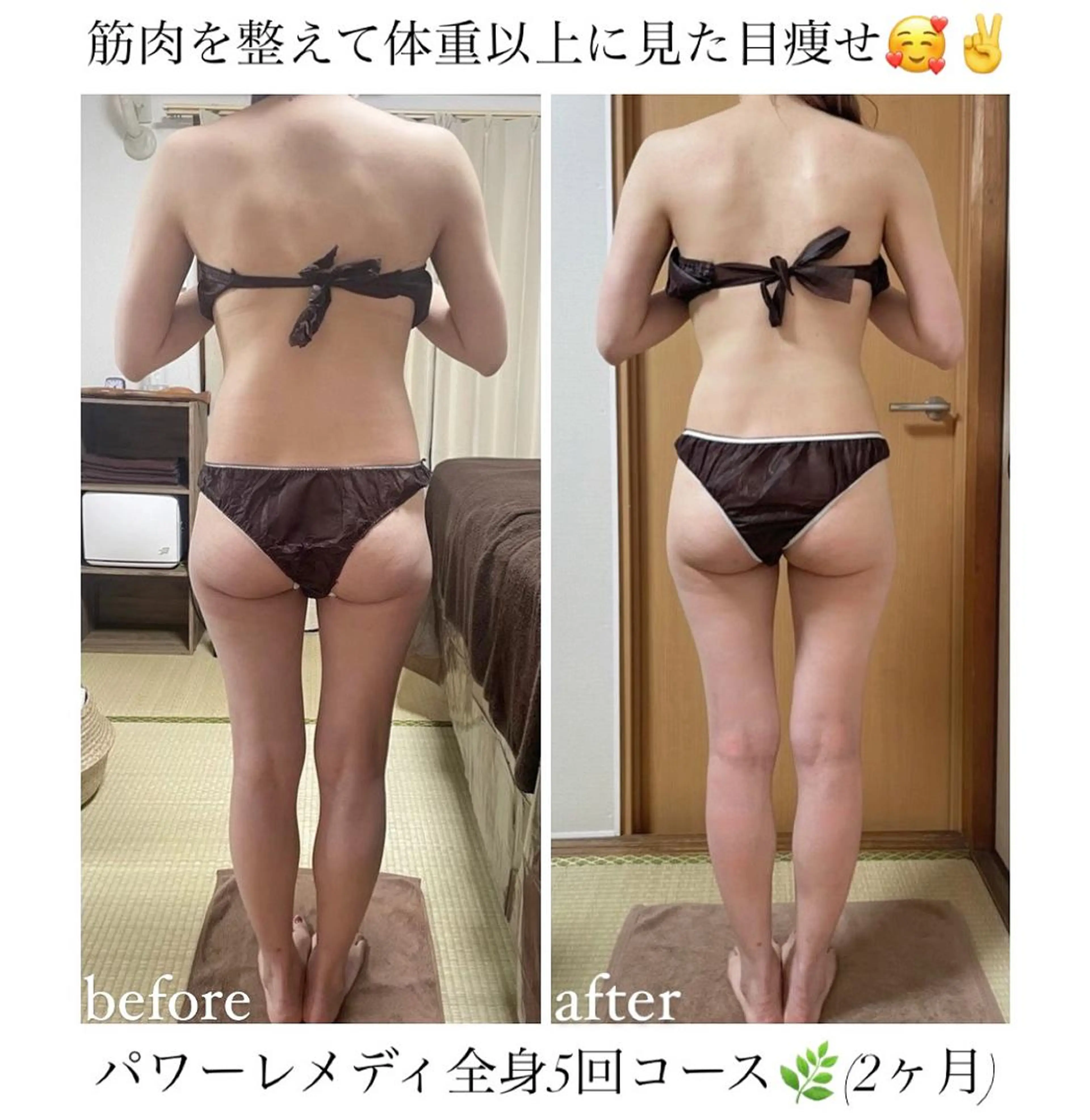 《本気痩せ×疲労改善 》  BILOOPのエステ・リラクイメージ