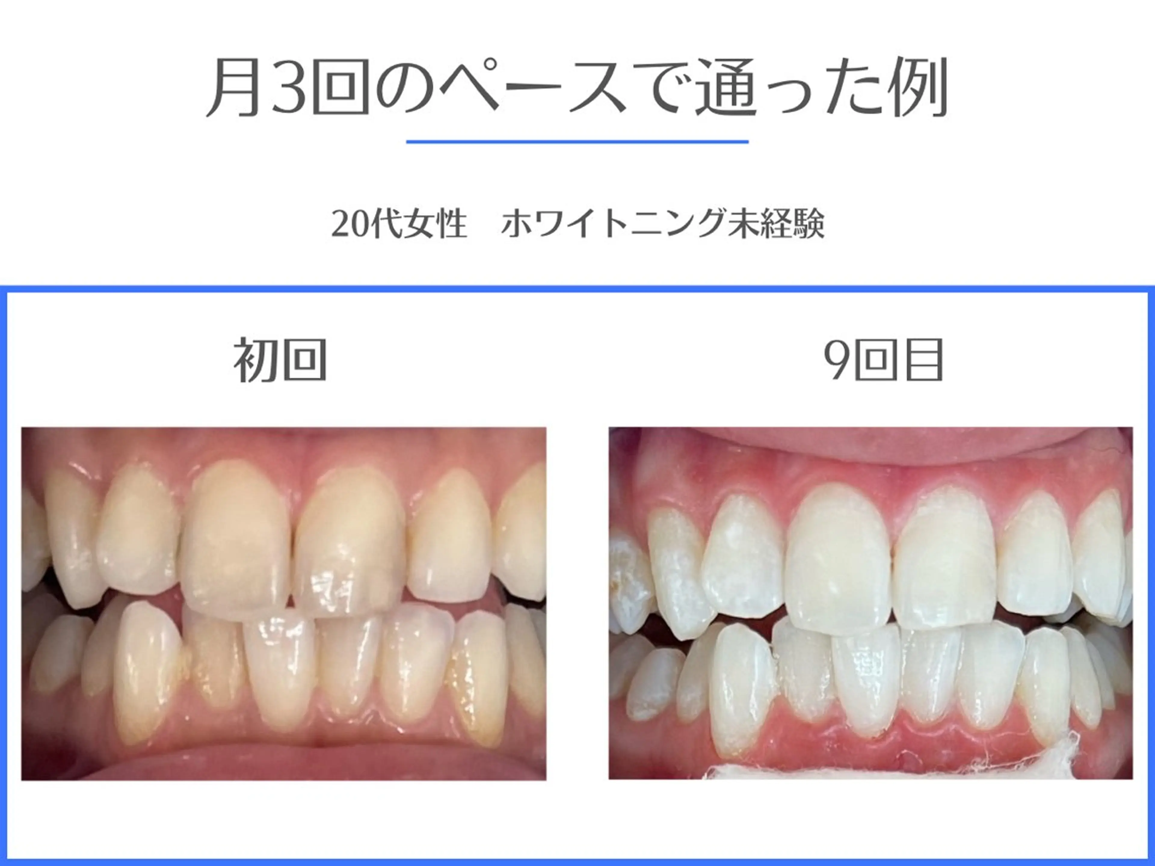 ホワイトニング/脱毛 専門店エクシア岡崎店のその他イメージ