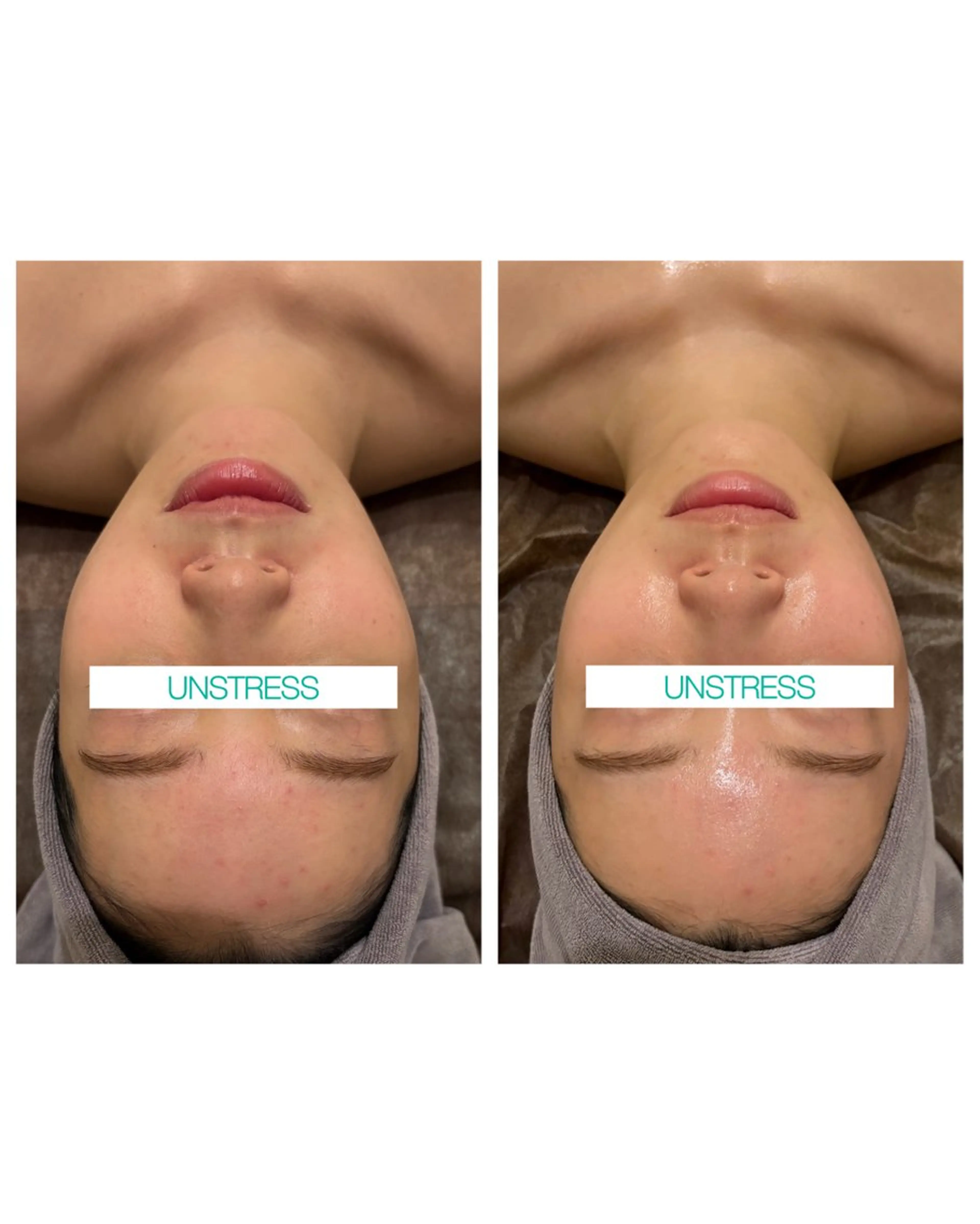 小顔コルギ ☆表参道/外苑前のエステ・リラクイメージ