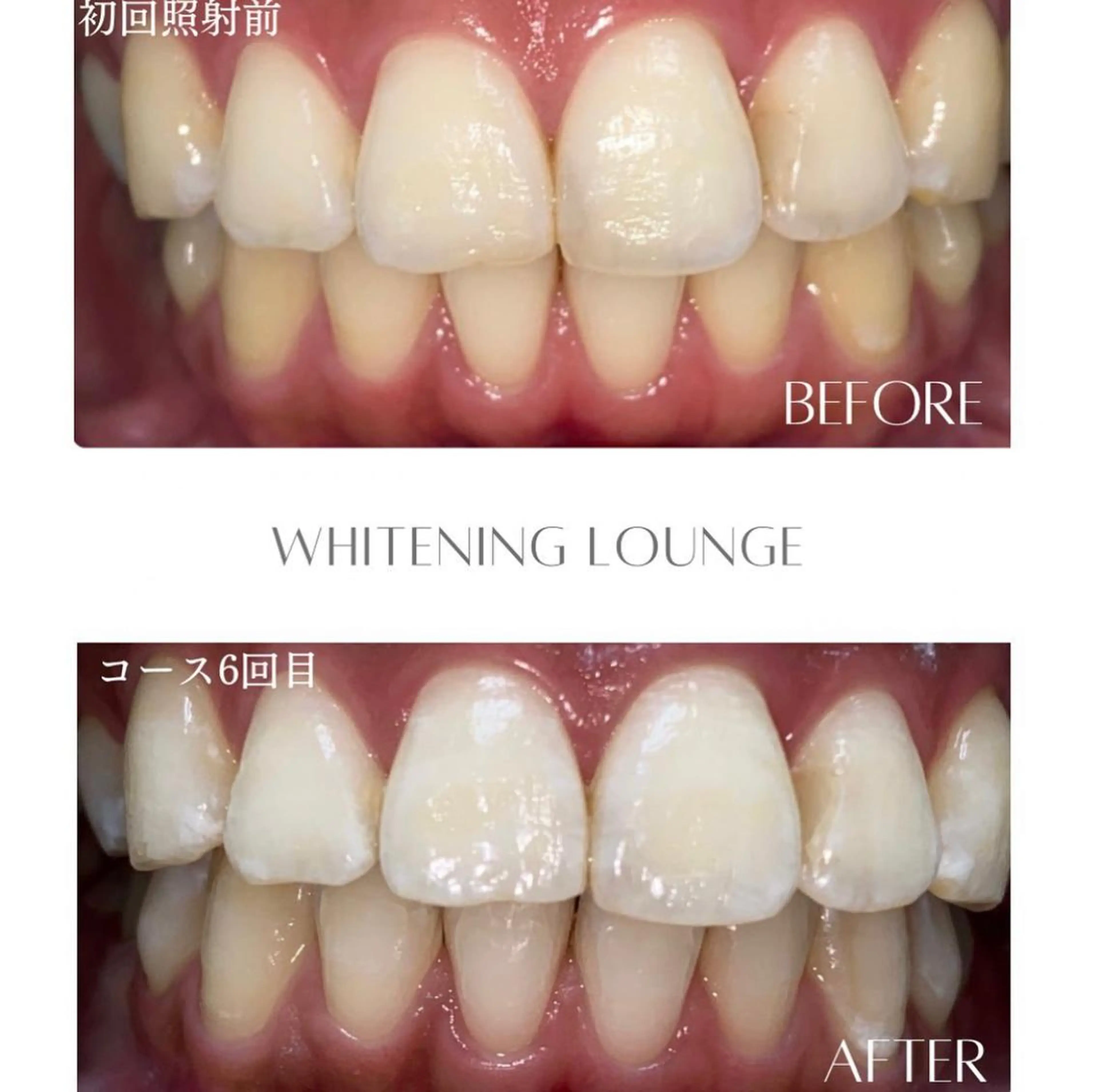 ホワイトニングラウンジ横須賀所属・ホワイトニング Lounge横須賀のエステ・リラクイメージ