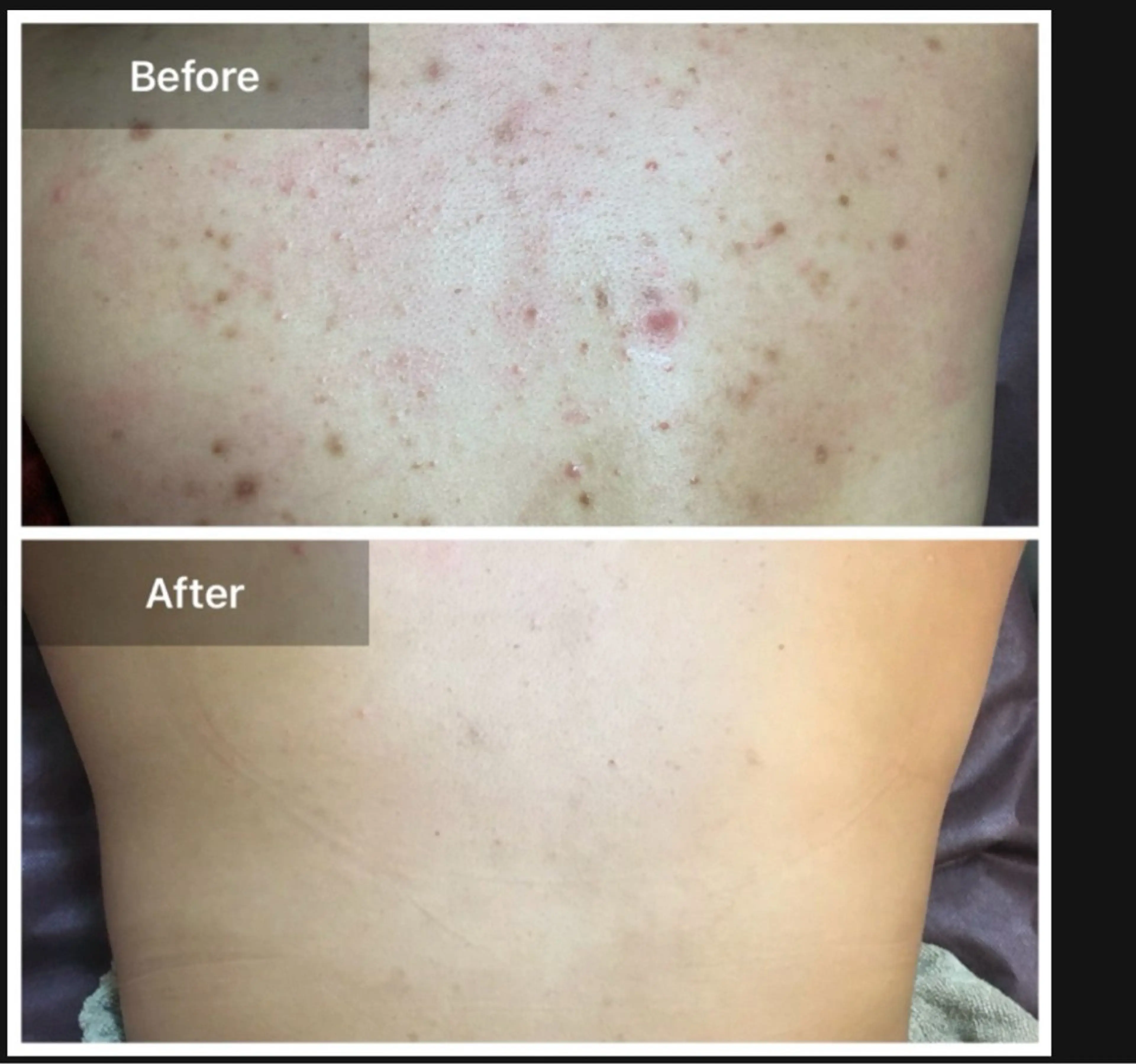 ハーブピーリング専門 MOKAのエステ・リラクイメージ