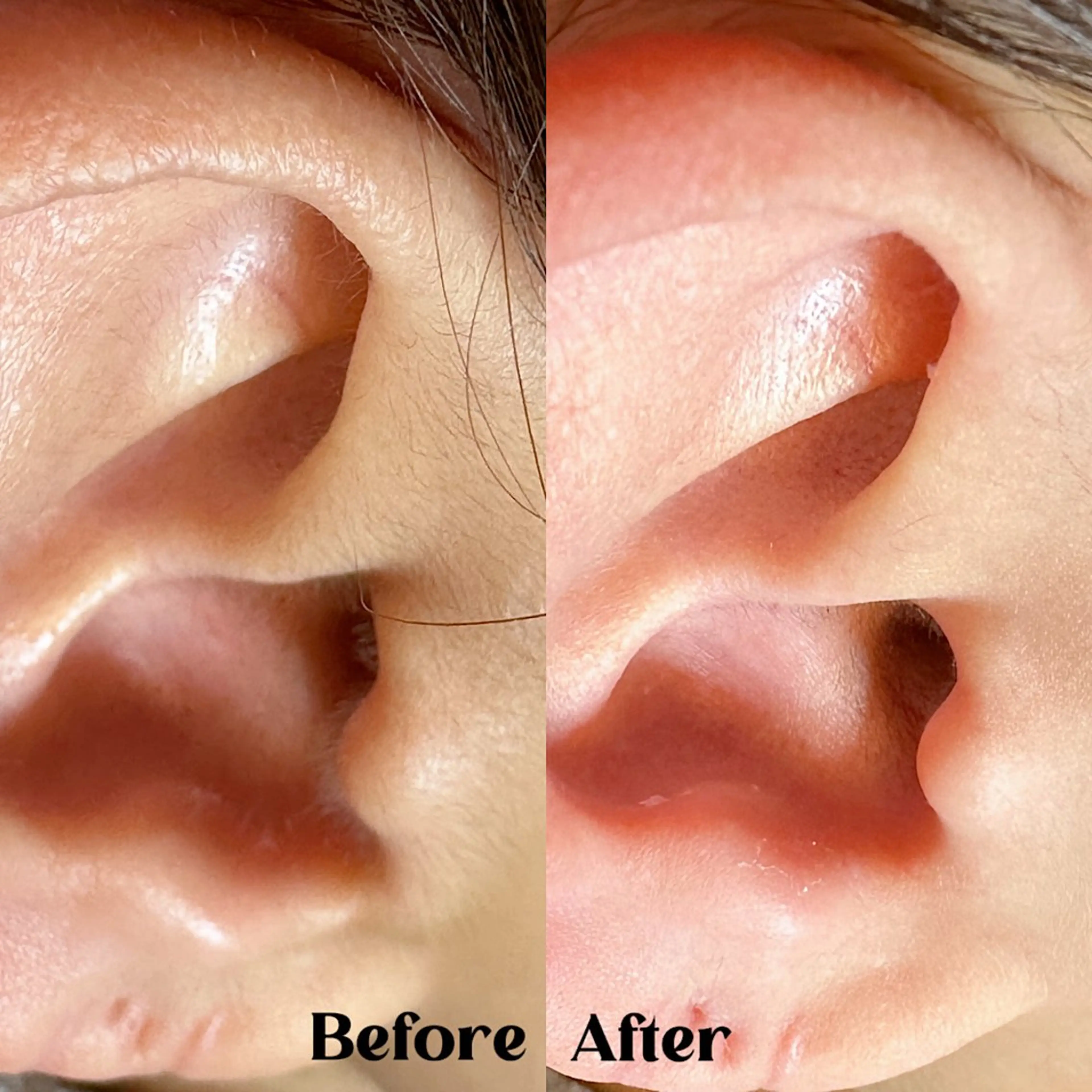 Hitomi シュガーリング豊橋のその他イメージ