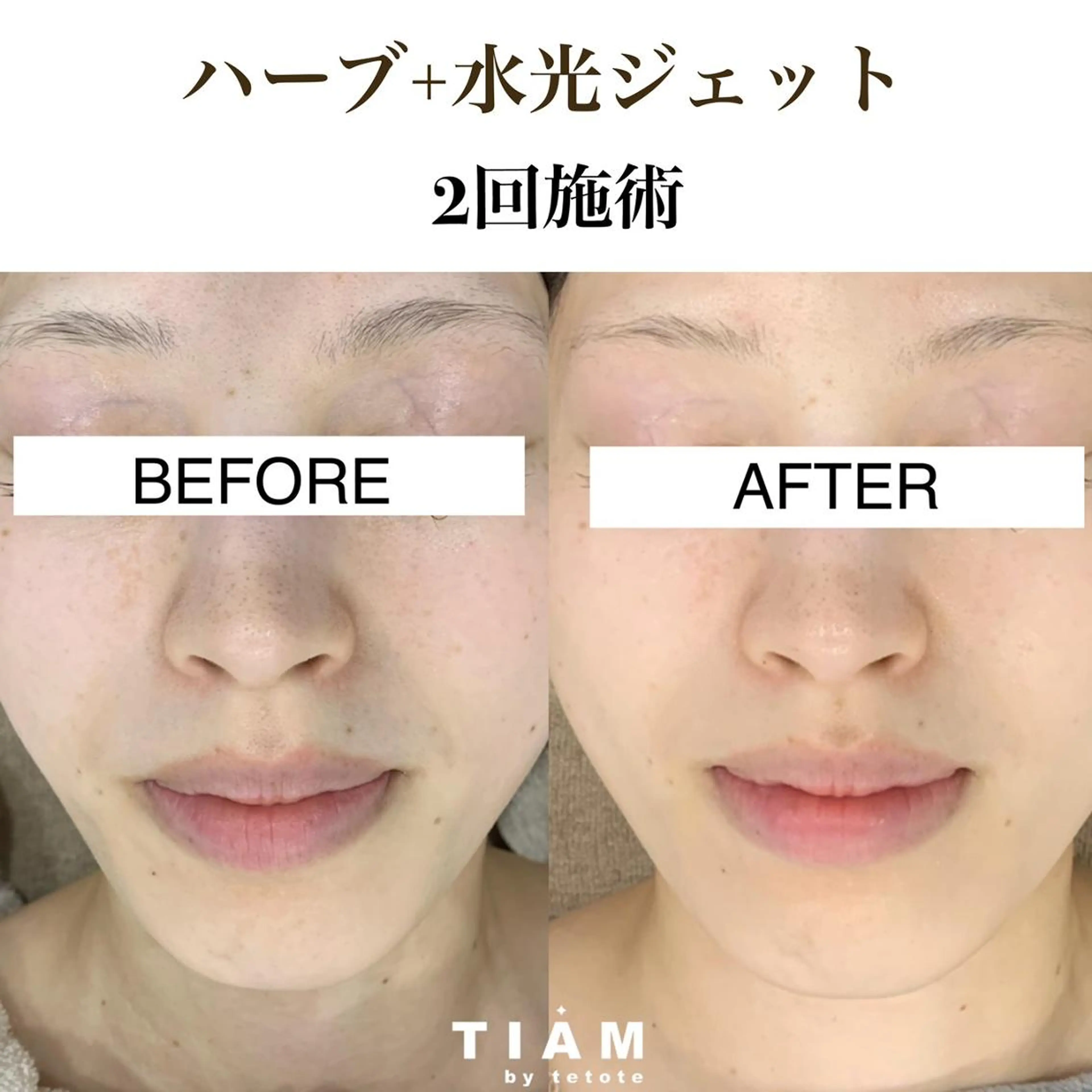 美肌サロンTIAM by tetoteのエステ・リラクイメージ