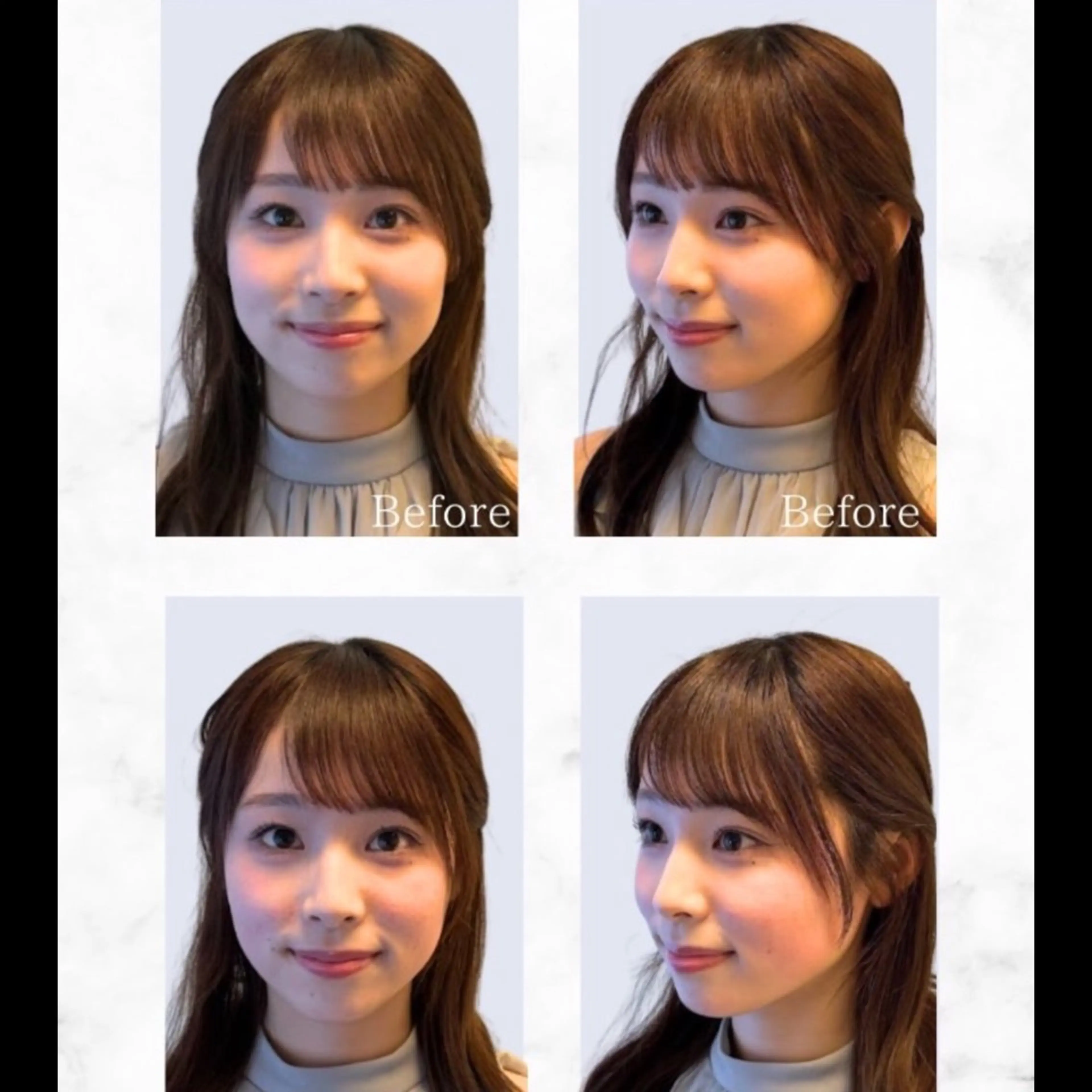 エステ リラク 渋谷 小顔美容鍼 専門サロン YZのエステ・リラクイメージ