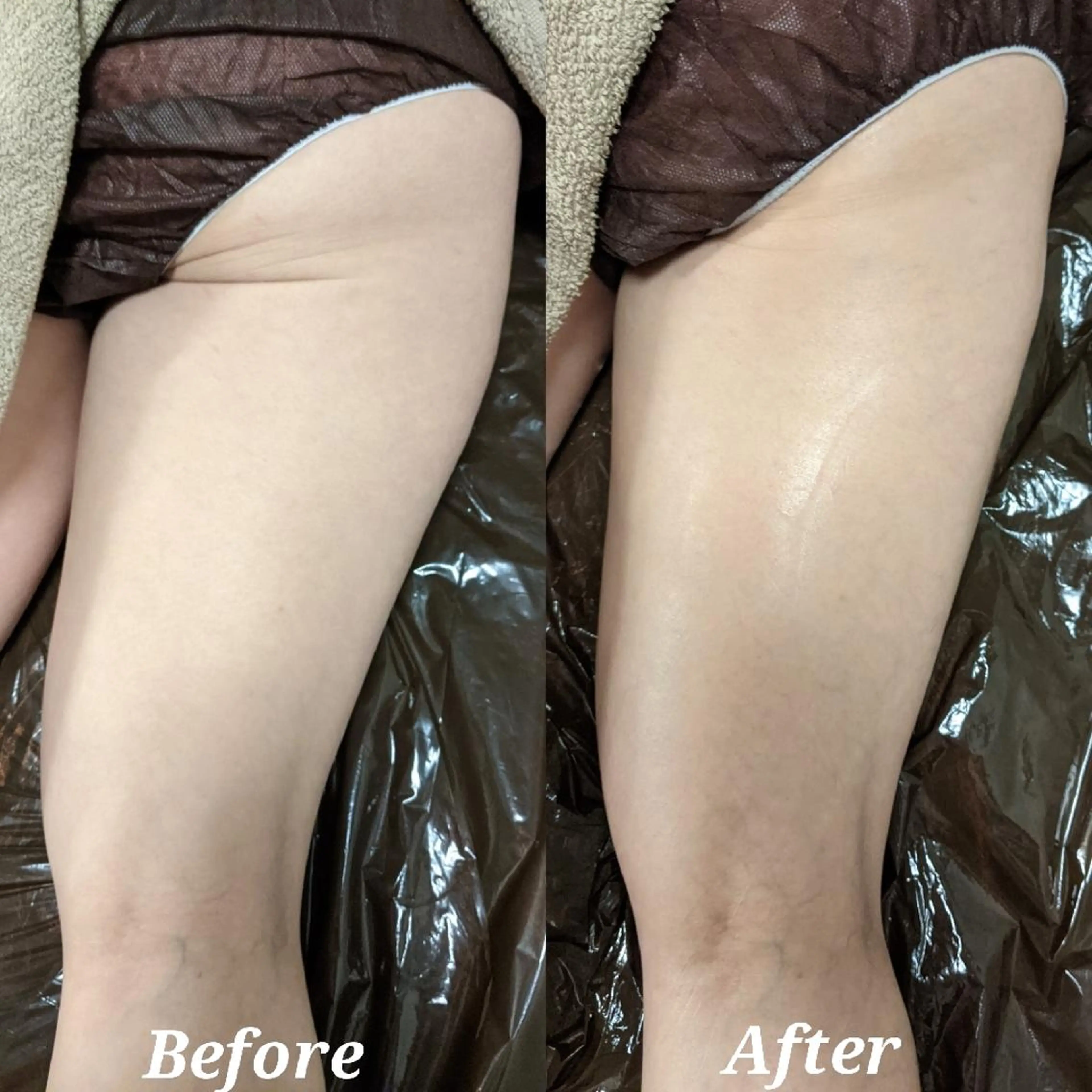 深層リンパオイル/小 顔とドライヘッドスパのエステ・リラクイメージ