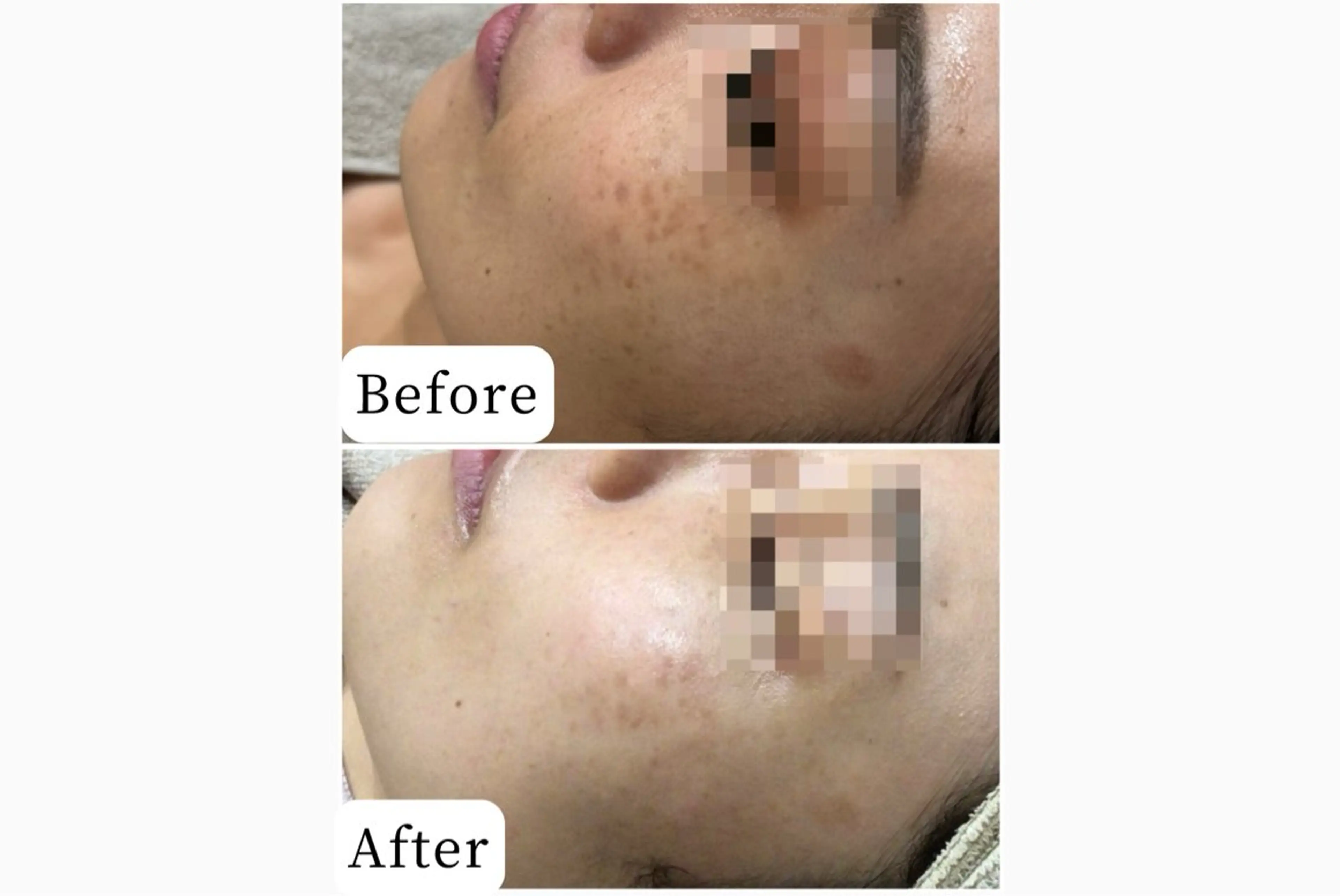 エステ 脱毛&フェイシャル 専門店muro.のエステ・リラクイメージ