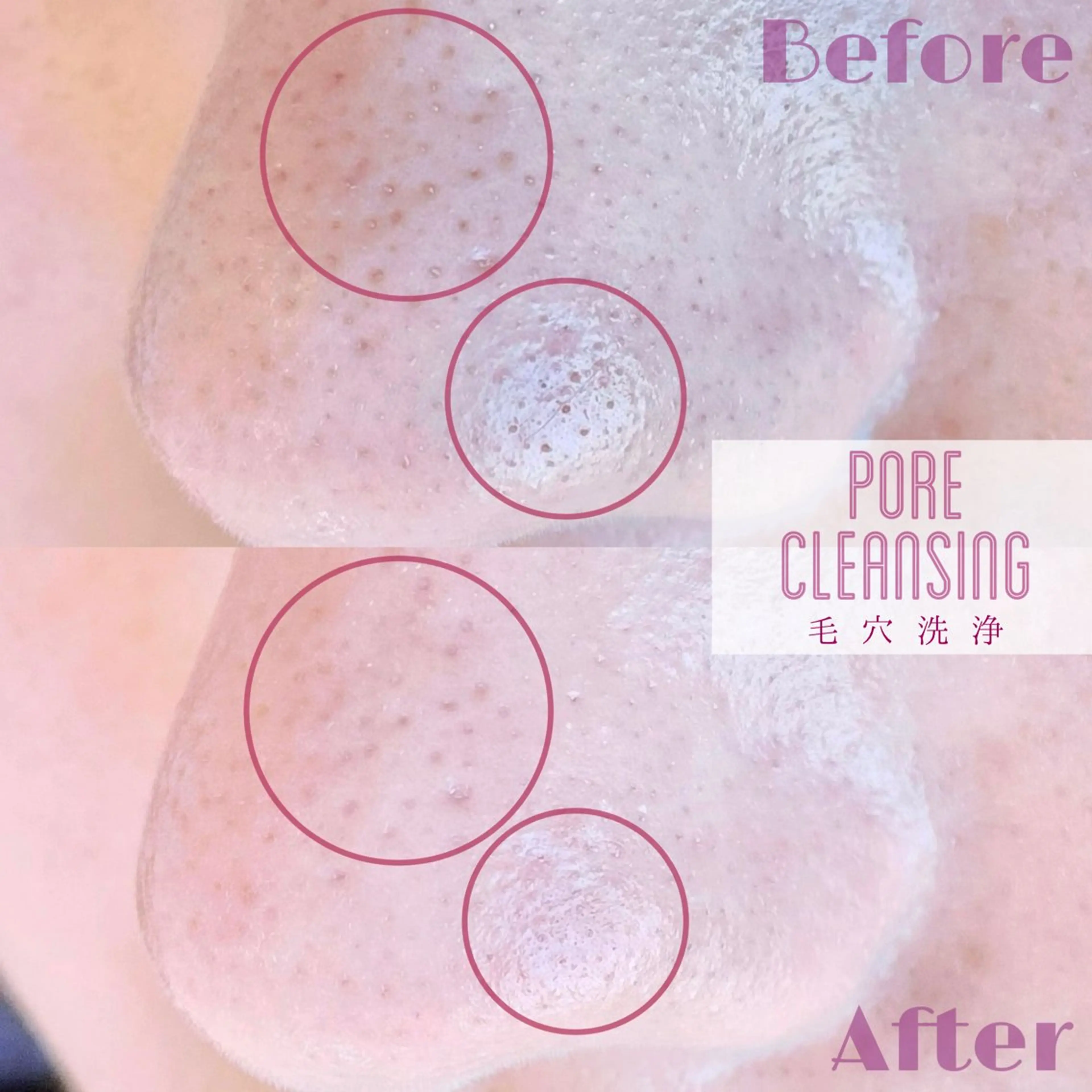 eye  salon Bonnyのマツエク・マツパデザイン