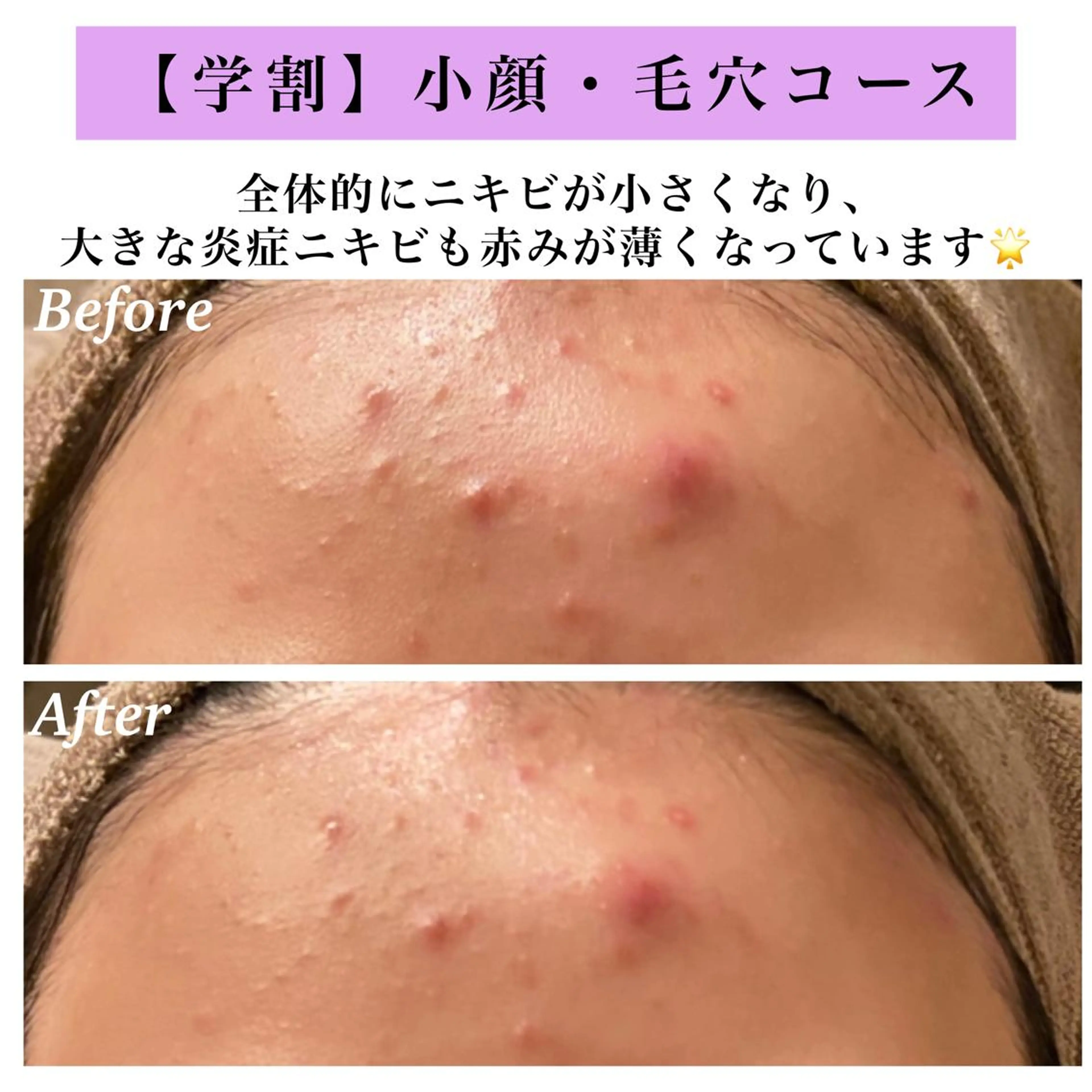 Bellesthe （ベルエステ）のエステ・リラクイメージ