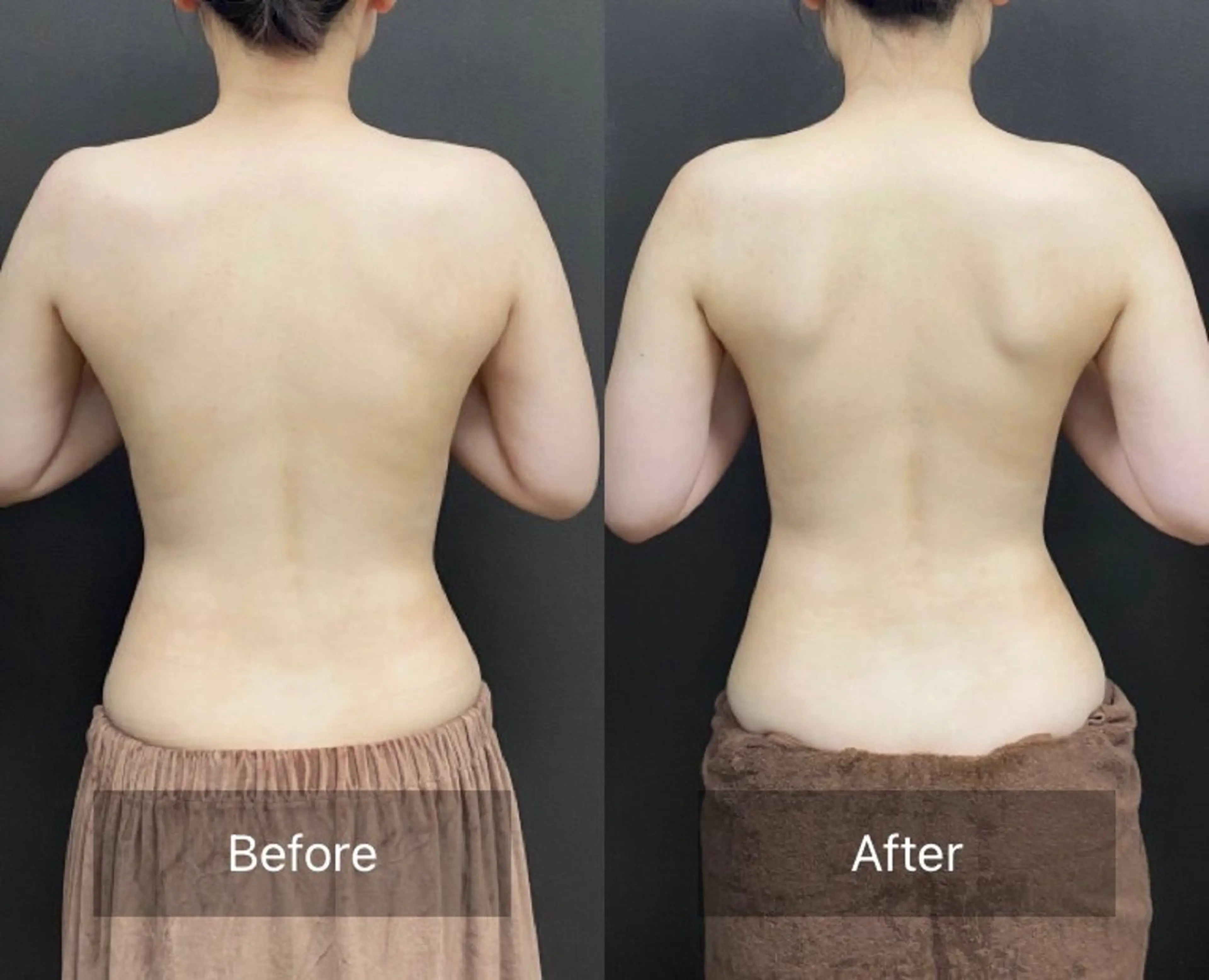 エステ ハーブピーリング🌿 𝑴𝒂𝒚𝒖のエステ・リラクイメージ