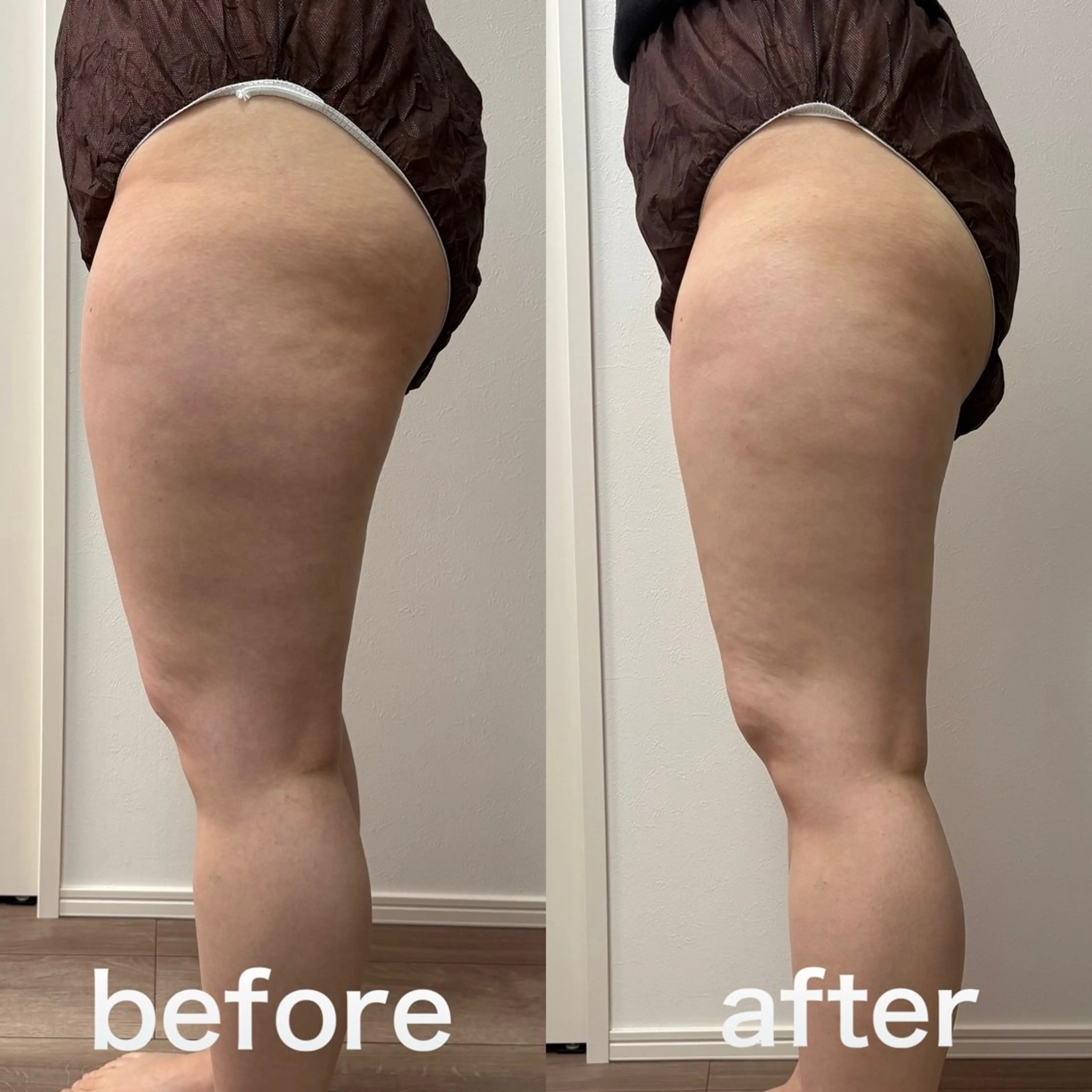 Miiju.所属・石巻 冷却痩身 Miiju. 鈴木のエステ・リラクイメージ