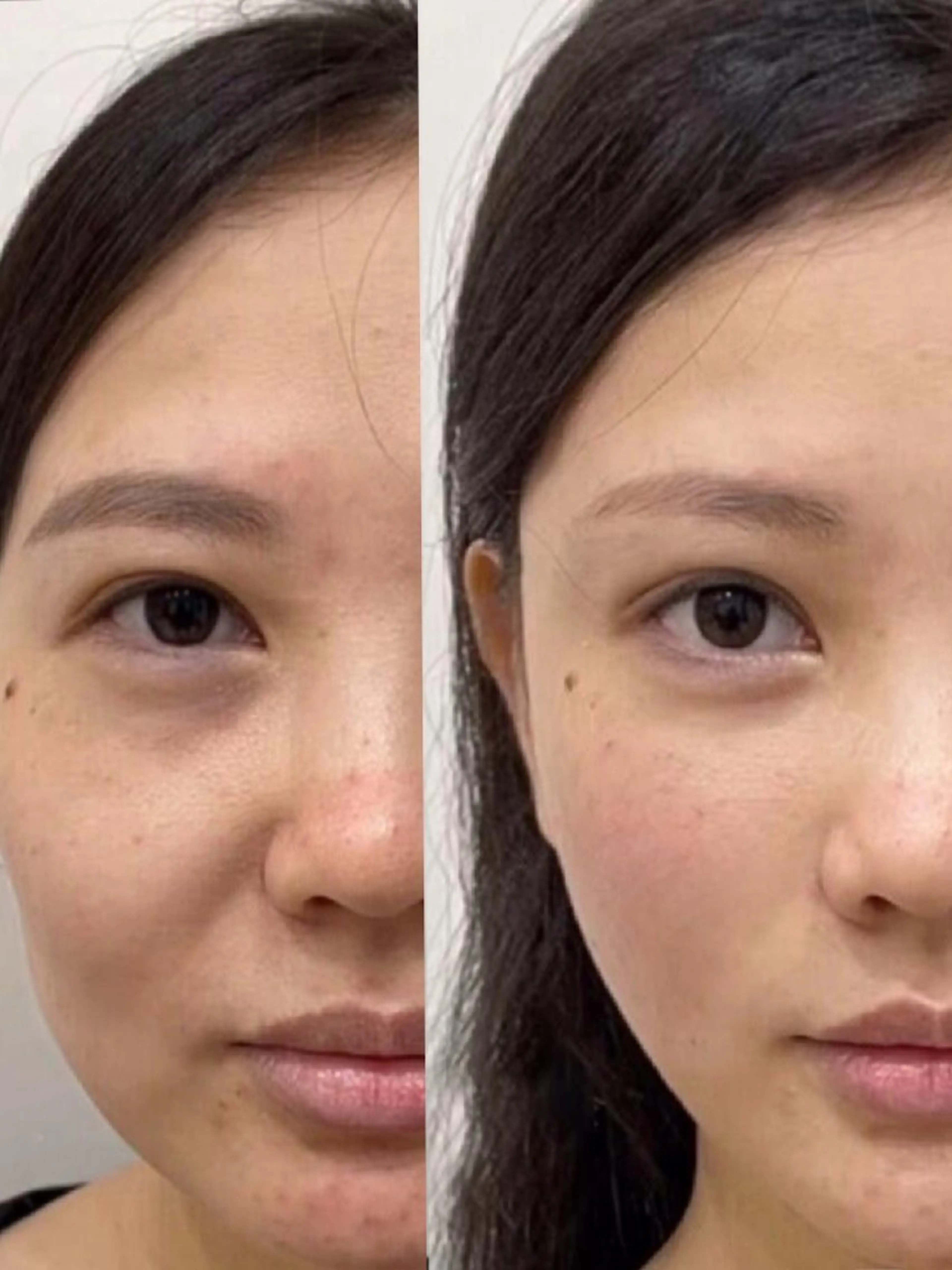 エステ aliaハーブ水光店 エステティシャン募集のエステ・リラクイメージ